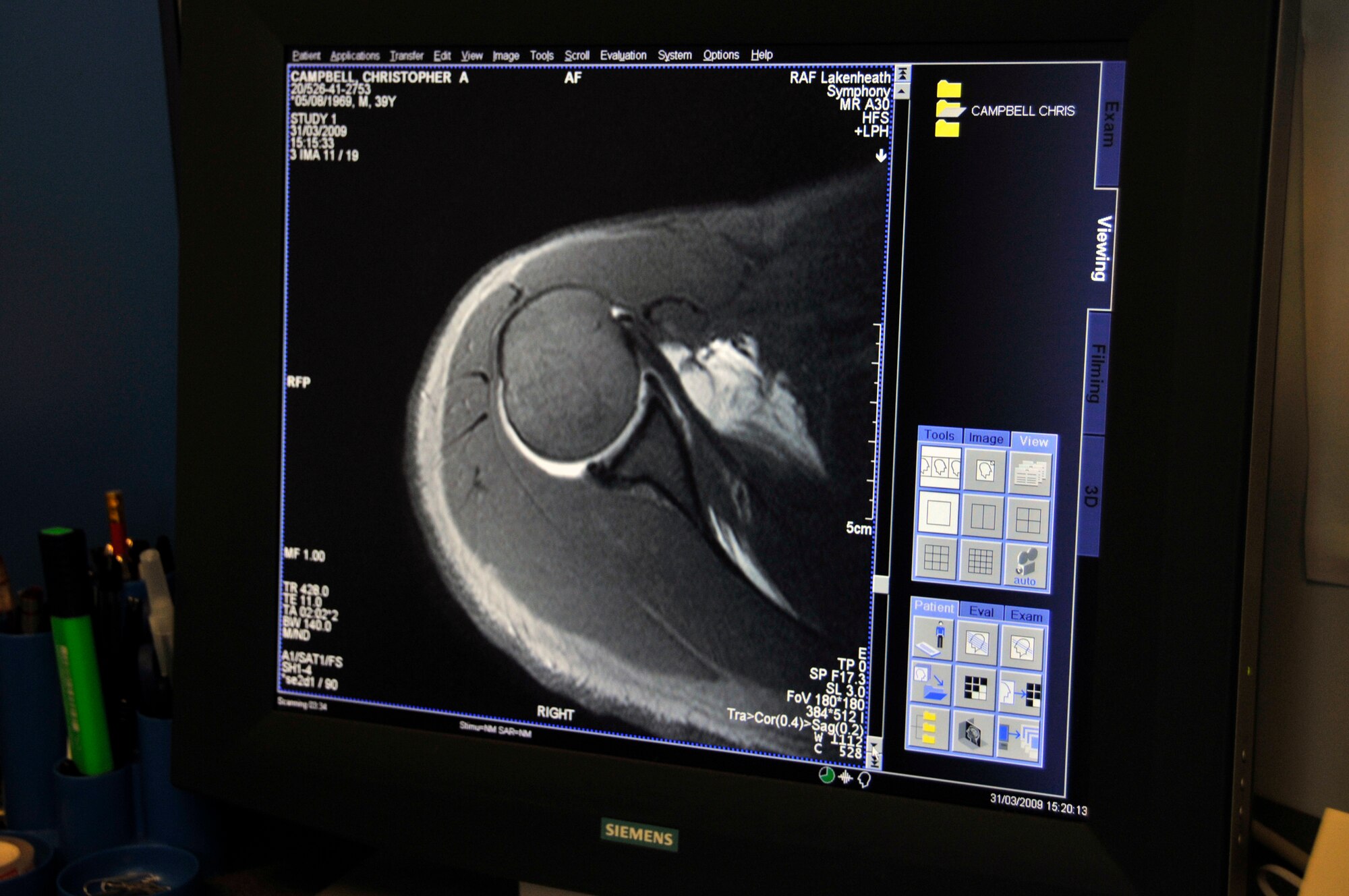 ROYAL AIR FORCE LAKENHEATH, England -- John McWilliams, InHealth MRI technician, is using high resolution monitors to review the sequence of images acquired during the MRI of Tech Sgt. Christopher Campbell 48th Fighter Wing Public Affairs NCO-in charge of internal operations here March 31, 2009. The MRI technician must ensure sufficient data has been collected for diagnosis. (U.S. Air Force photo by Airman 1st Class Perry Aston) (Released)