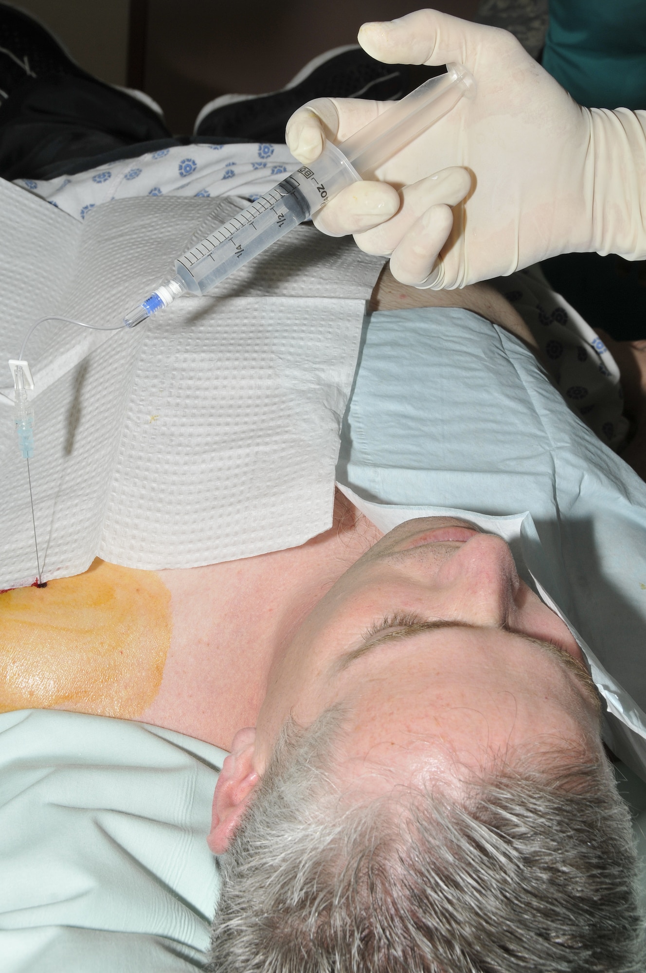 ROYAL AIR FORCE LAKENHEATH, England -- Major Douglas White, 48th Medical Operations Squadron is injecting Omnipaque and Magnevist, IV Contrast solutions, into the shoulder of Tech Sgt. Christopher Campbell 48th Fighter Wing Public Affairs NCO-in charge of internal operations here this procedure was in preparation for his MRI March 31, 2009. Sergeant Campbell had a MRI scan performed on his injured shoulder. (U.S. Air Force photo by Airman 1st Class Perry Aston) (Released)
