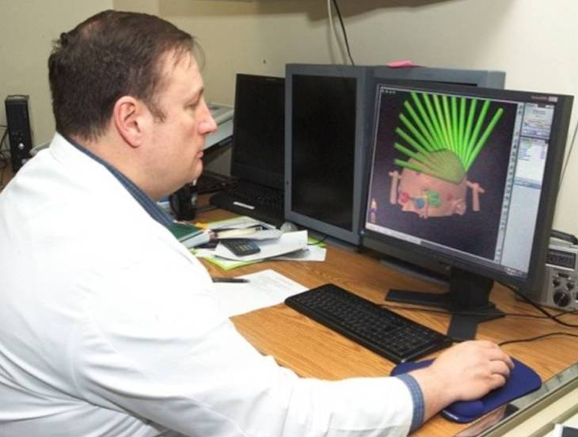 Dr. (Maj. USAF Ret) Paul Hanny, Medical Physicist planned the stereotactic radiosurgery fanlike array of radiation beams that pinpointed the radiation treatment at Pamela Bishop’s metastatic brain tumor.