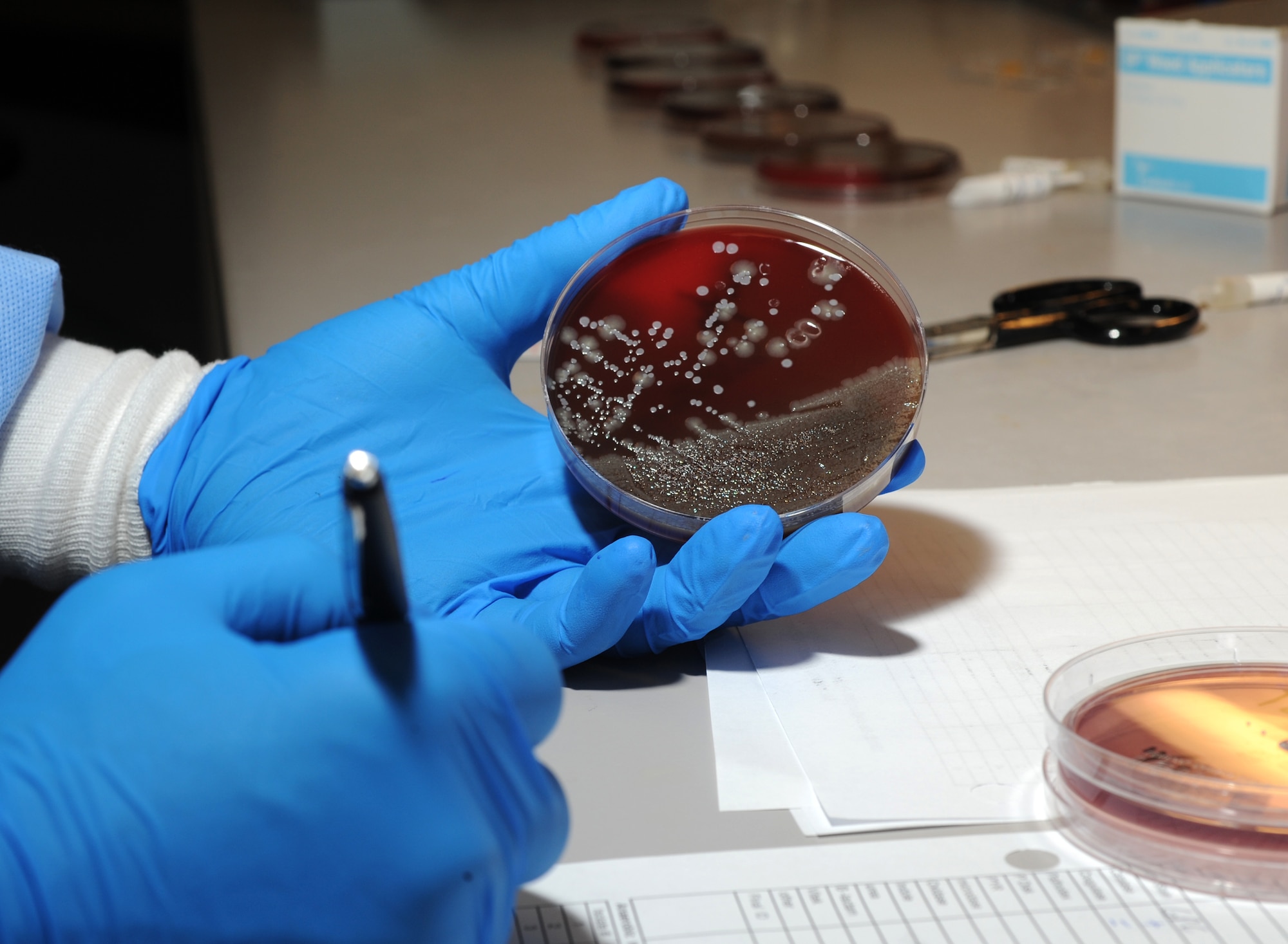 ELMENDORF AIR FORCE BASE, Alaska-- Bacterial testing is used for a variety of reasons including urine samples, blood samples and throat swabs.These colonies can grow as fast as 12 to 24 hours (U.S. Air Force photo by Airman First Class Kristin High)