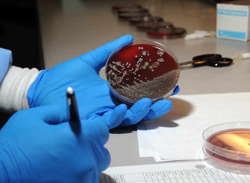 urine test