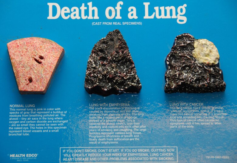 ANDERSEN AIR FORCE BASE, Guam – This model on display at the health and wellness center shows the difference between a normal lung, a lung stricken with emphysema and a cancerous lung. Prolonged tobacco usage leads to many health problems and places financial burdens on the user. (U.S. Air Force photo by Senior Airman Shane Dunaway)