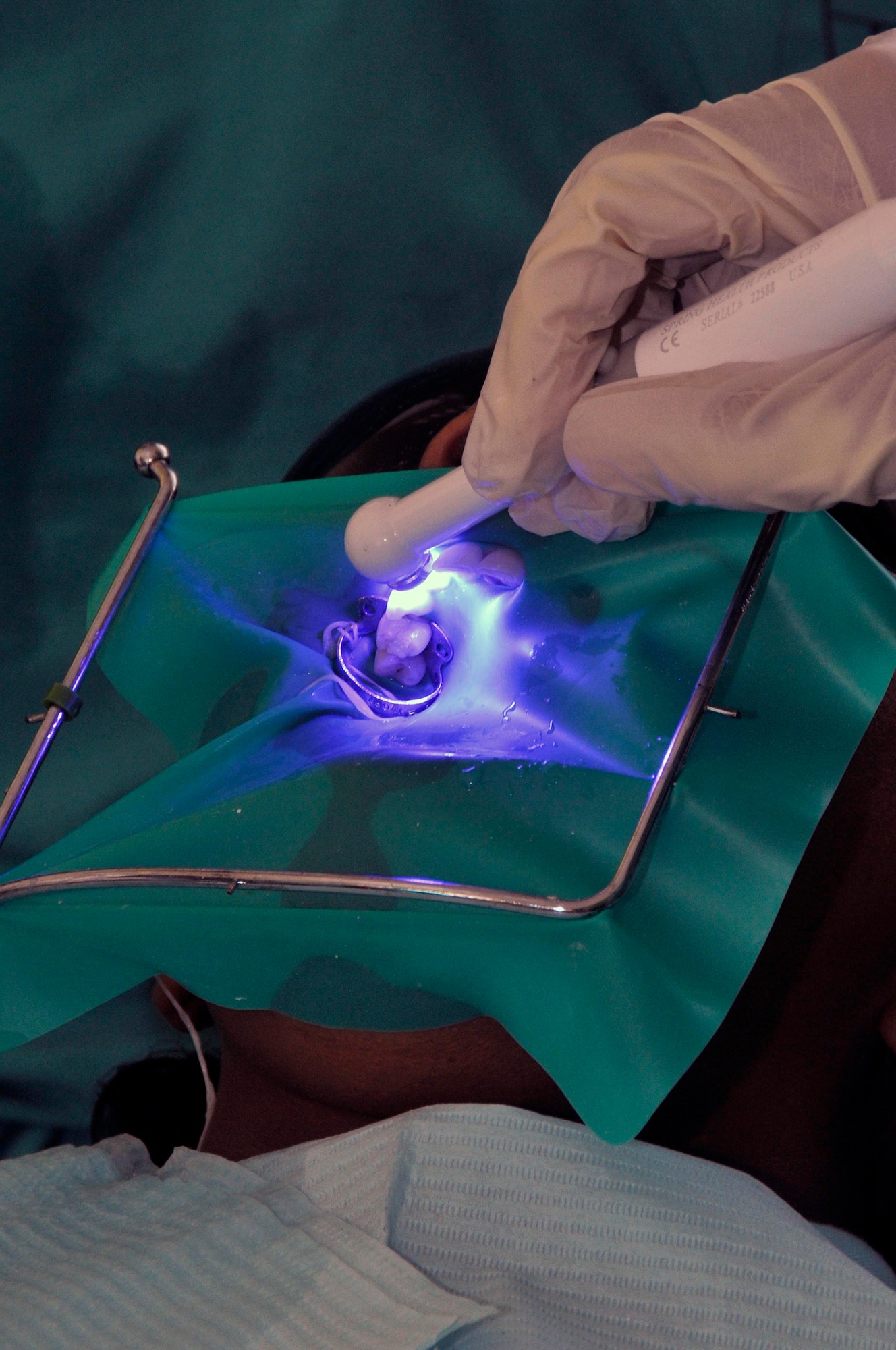 Tech. Sgt. Shanette Jean, dental technician from the 375th Dental Squadron, Scott AFB, Illinois, hardens a Guyanese woman's filling with a light curer, during New Horizons Guyana, at the Diamond School Aug 10, 2009, in Diamond, Guyana. New Horizons Guyana 2009 is a U.S. Southern Command-sponsored humanitarian event that will benefit thousands of Guyanese citizens in Georgetown and outlying areas.(U.S. Air Force photo by Airman 1st Class Perry Aston) (Released)