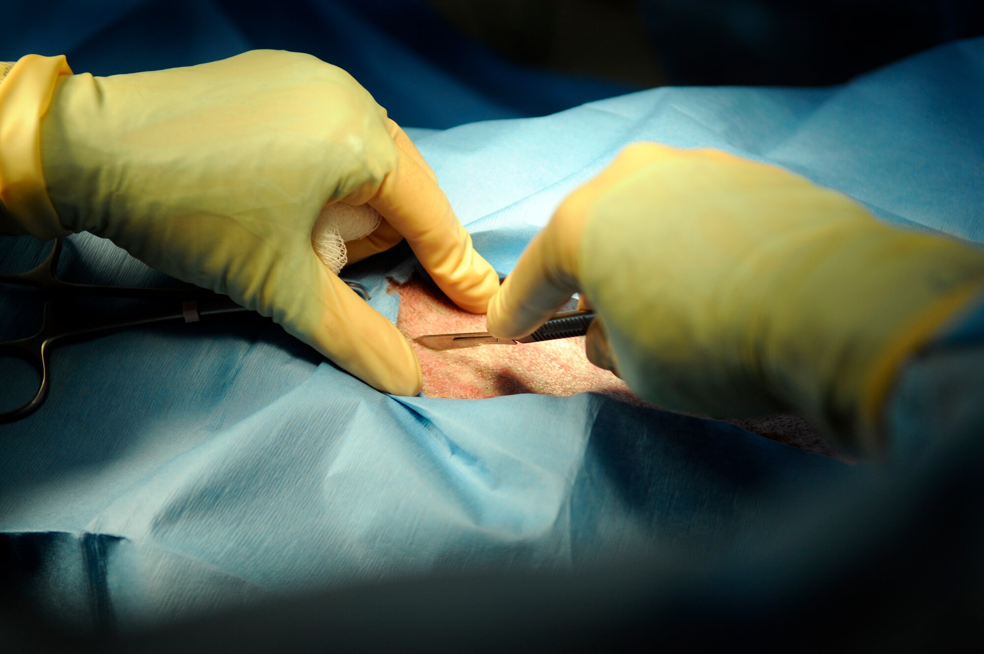 With a steady hand, Army Maj. (Dr.) Katheryn Hanson, the Incirlik Veterinarian, prepares to make an incision in Suli, a 39th Security Forces Squadron military working dog, during his prophylactic gastropexy, also referred to as stomach tacking, to prevent gastric torsion, or twisting of the stomach Thursday, Aug. 27, 2009 at the Veterinary Clinic, Incirlik Air Base, Turkey.  The surgery was completed after a recommendation by the Army, the service in charge of medical care for the military working dog program, for all dogs in the program to receive the surgery.  Stomach twisting is caused by gastric dilatation and volvulus, commonly known as bloat, the second leading killer of dogs after cancer.  (U.S. Air Force photo/Staff Sgt. Raymond Hoy)