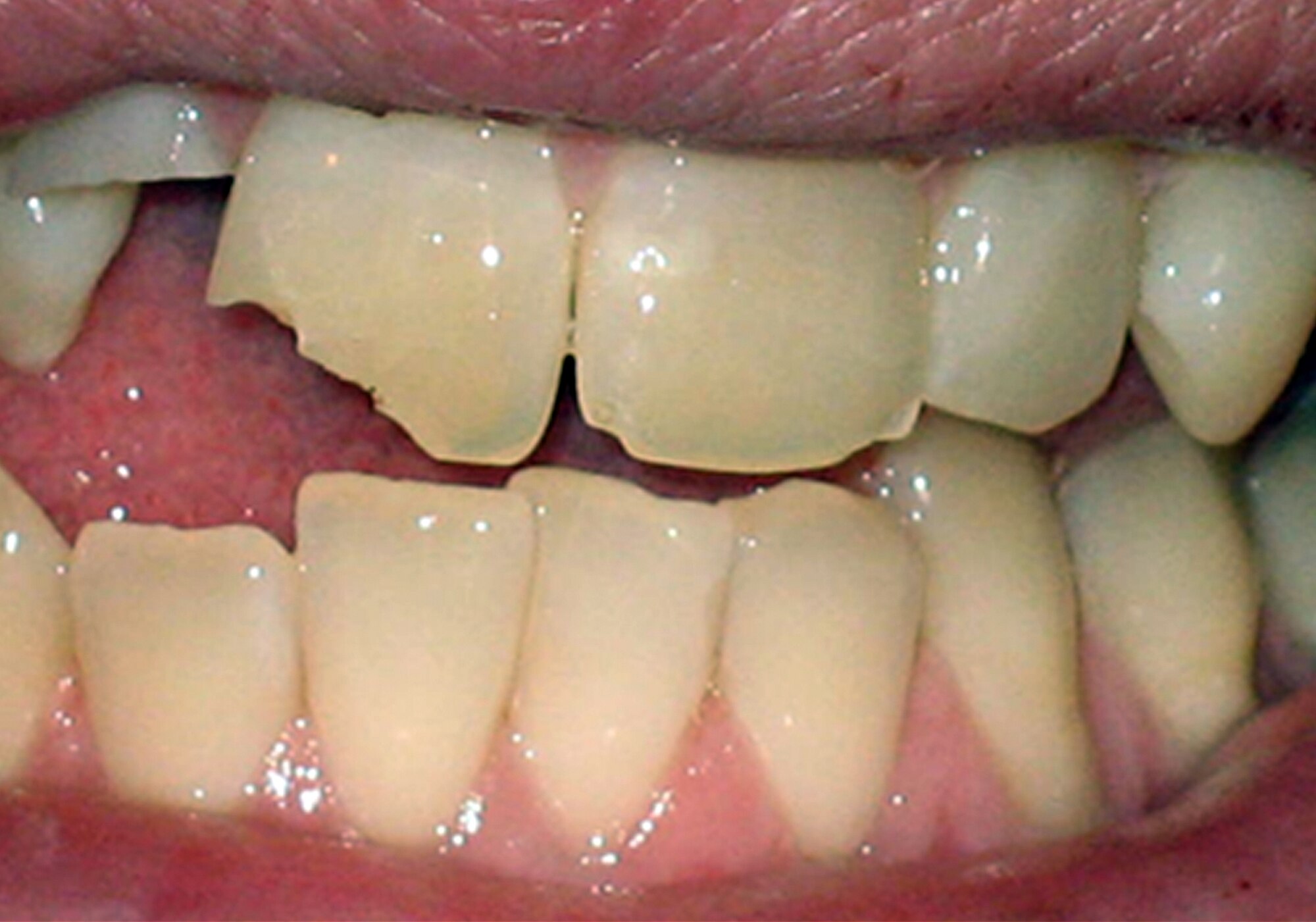 Dental problems can be painful and if in doubt on how best to handle an issue, a dentist should be called. Preventative actions such as good oral hygiene and exams can help avoid problems. (courtesy photo)