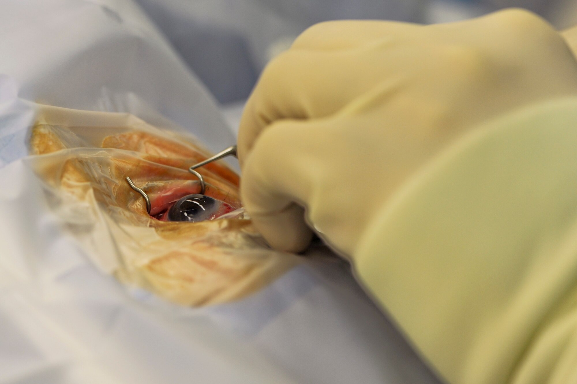 Maj. (Dr.) Vasudha Panday performs corneal transplantation on Gloria Bolick Dec. 22, 2009, at Wilford Hall Medical Center at Lackland Air Force Base, Texas. Doctor Panday is assigned to the 59th Medical Wing. (U.S. Air Force photo/Staff Sgt. Desiree N. Palacios) 
