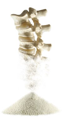 In the U.S. today, more than 44 million people over the age of 50 have osteoporosis or osteopenia, a possible precursor to osteoporosis.