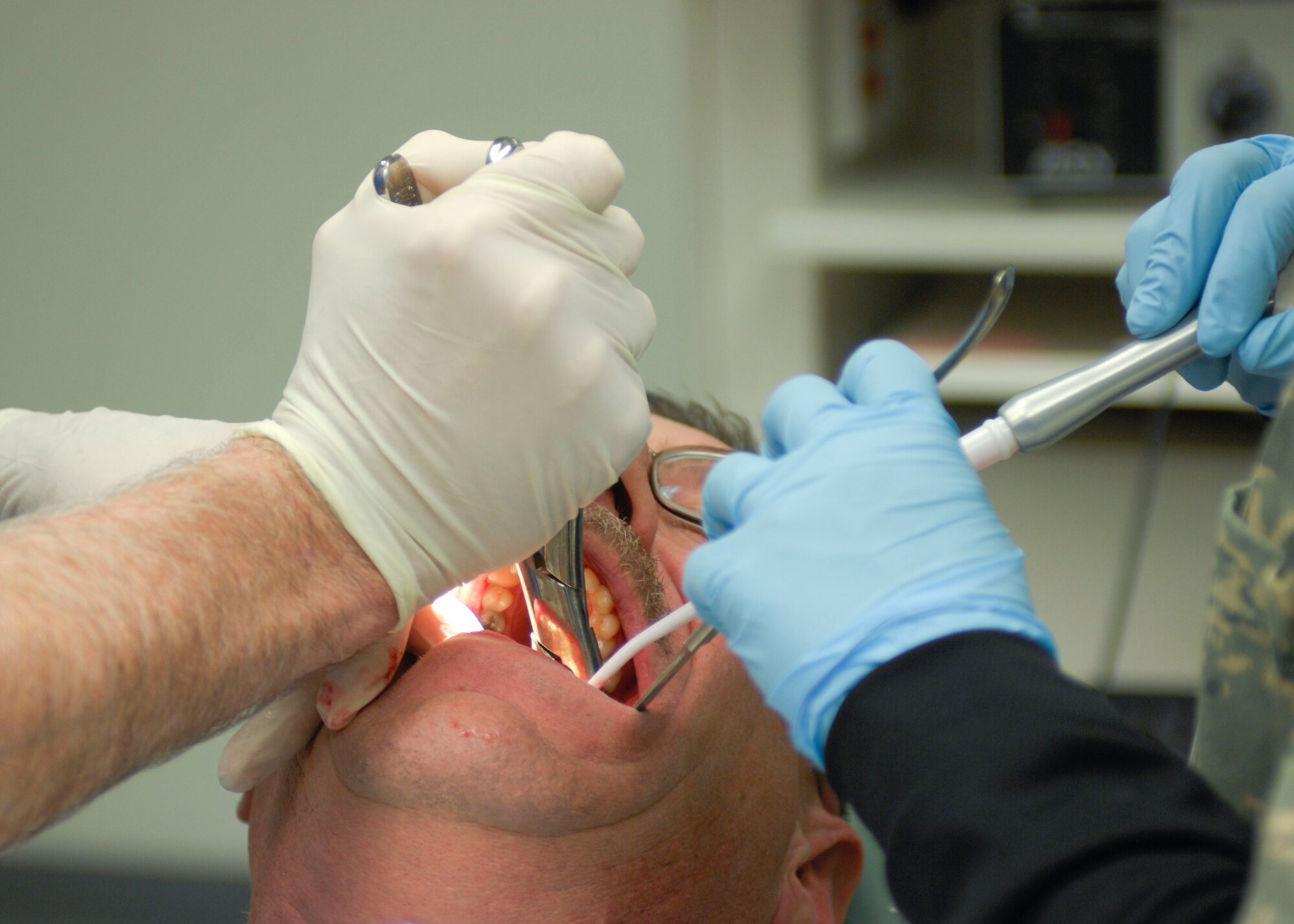 Col. Dennis Hayes, 455th Expeditionary Medical Group officer-in-charge of dental, and Senior Airman Chelsie Smith, 455th EMDG dental technician, extract the tooth of Tech. Sgt. Joseph Gross, 455th Expeditionary Maintenance Squadron at Craig Joint Theater Hospital, Bagram Air Field, Afghanistan, Feb. 16. Emergency dental care is open six days a week, twenty four hours a day. Colonel Hayes is deployed from the 375th Dental Squadron, Scott AFB, Ill. Sergeant Gross is deployed from the 153rd AMXS, Wyoming Air National Guard. (U.S Air Force photo/ Senior Airman Erik Cardenas)(Released)  