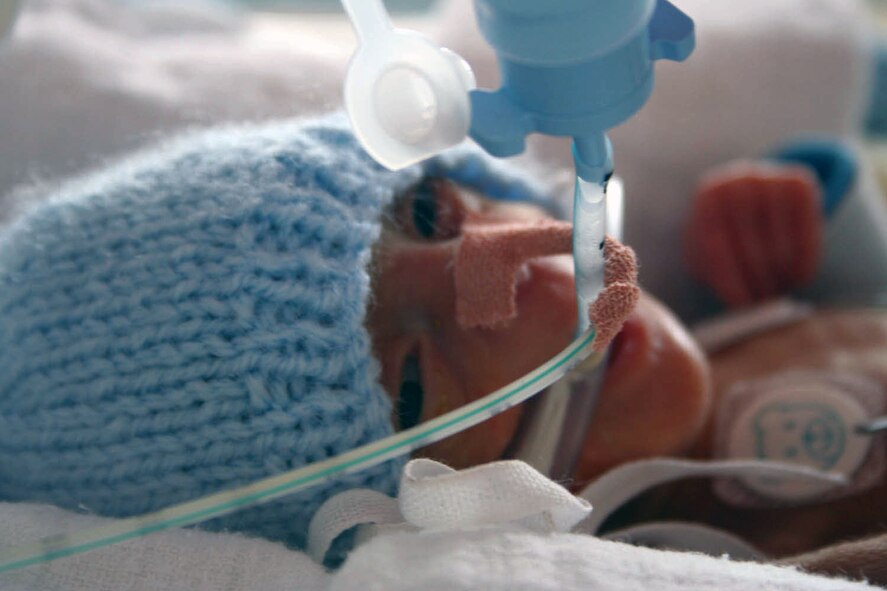 Eric LeVon Frazier II, one of premature twins born Sept. 6, died Dec. 10 at Norfolk and Norwich University Hospital in England. Eric and his sister, Alexis Rain Frazier, were born at just 23 weeks and three days gestation period. They were due Jan. 1. This photo of Eric, his parents' favorite, was taken around Thanksgiving. His dad, Tech. Sgt. Barry Frazier of the 100th Air Refueling Wing Legal Office, and his wife, Mandy, said their youngest son taught them to fight and never give up. (Courtesy photo) 