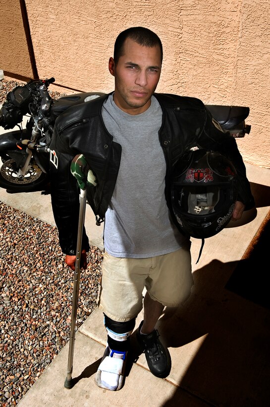 After blowing out a tire, Senior Airman Trevor Adams of Kirtland AFB, N.M., lost control of his motorcycle while going 70 mph. He crashed and then was run over by two vehicles, resulting in torn ligaments in his right knee, nerve damage to his foot and some road rash. He credits the minimal injuries to his protective gear. (photo by Tech. Sgt. Matthew Hannen)