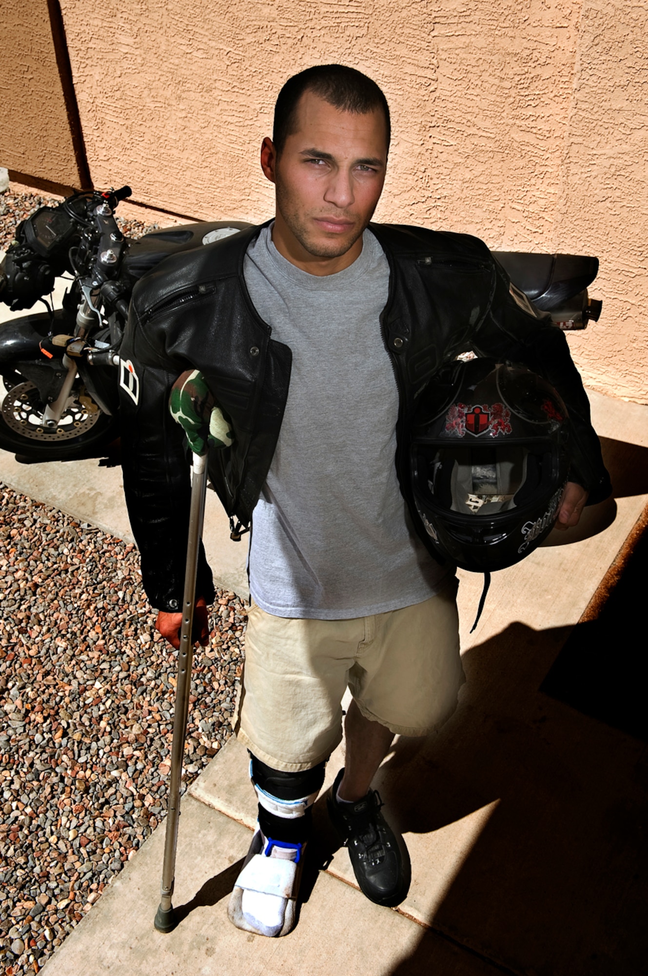 After blowing out a tire, Senior Airman Trevor Adams of Kirtland AFB, N.M., lost control of his motorcycle while going 70 mph. He crashed and then was run over by two vehicles, resulting in torn ligaments in his right knee, nerve damage to his foot and some road rash. He credits the minimal injuries to his protective gear. (photo by Tech. Sgt. Matthew Hannen)