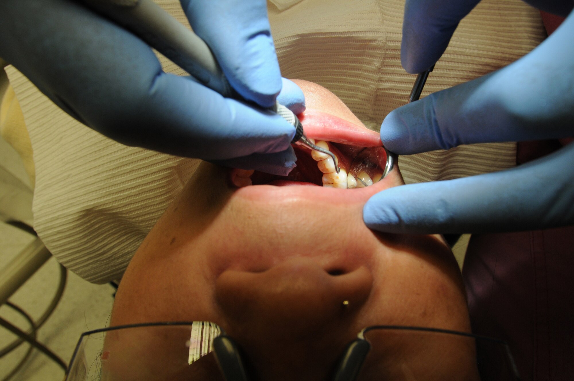 Tech. Sgt. Vicki Johnson performs a scaling and root planning procedure on a patient at RAF Lakenheath, June 14, 2009. She is a registered dental hygienist with the 48th Dental Squadron. She works in the Periodontal Department, along with about four others. The small care-giving team is responsible for providing periodontal care for all personnel from all branches of the service and their families stationed in the United Kingdom. (U.S. Air Force photo by Staff Sgt. Nathan Gallahan)