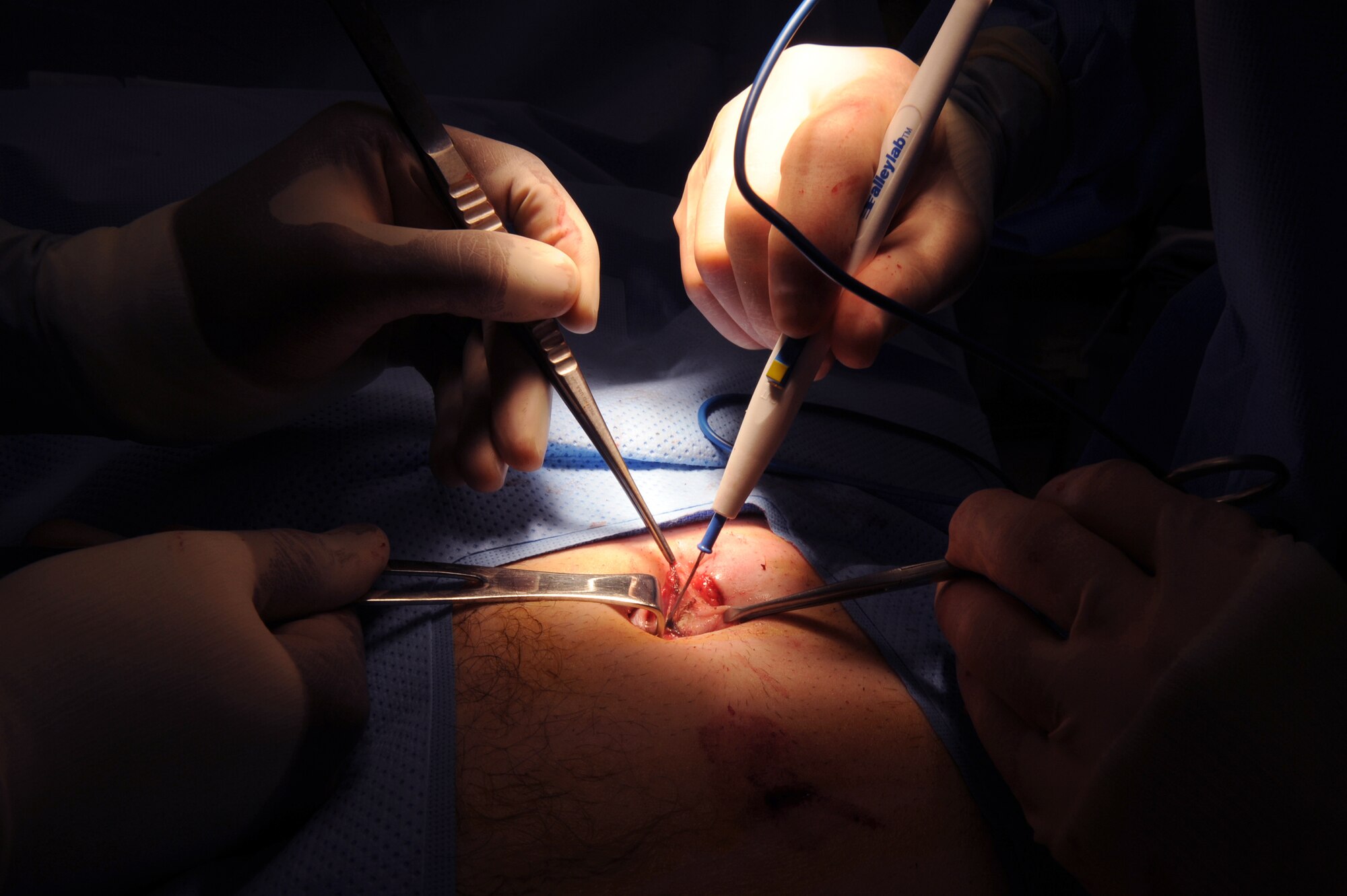 Staff Sgt. Troy Leach, a 379th Expeditionary Medical Group surgical clinic and respiratory therapist, assists Major (Doctor) Brian Holt, 379th Expeditionary Medical Group general surgeon, in closing an incision during an inguinal hernia surgery, June 5, 2009, at an undisclosed location in Southwest Asia.  This specific surgery allows the patient to return to duty quicker and with less pain.  The surgeries performed here range from elective to acute emergencies.  The surgical team provides treatment for patients coming in from all over the U.S. Central Command's Area of Responsibility.  Sergeant Leach hails from Nashville, Tenn. and is deployed from Keesler Air Force Base, Miss.  Major Holt hails from St. Peters, Mo. and is deployed from Misawa Air Base, Japan.  Both are deployed in support of Operations Iraqi and Enduring Freedom and Combined Joint Task Force - Horn of Africa.  (U.S. Air Force photo/Senior Airman Andrew Satran/released)