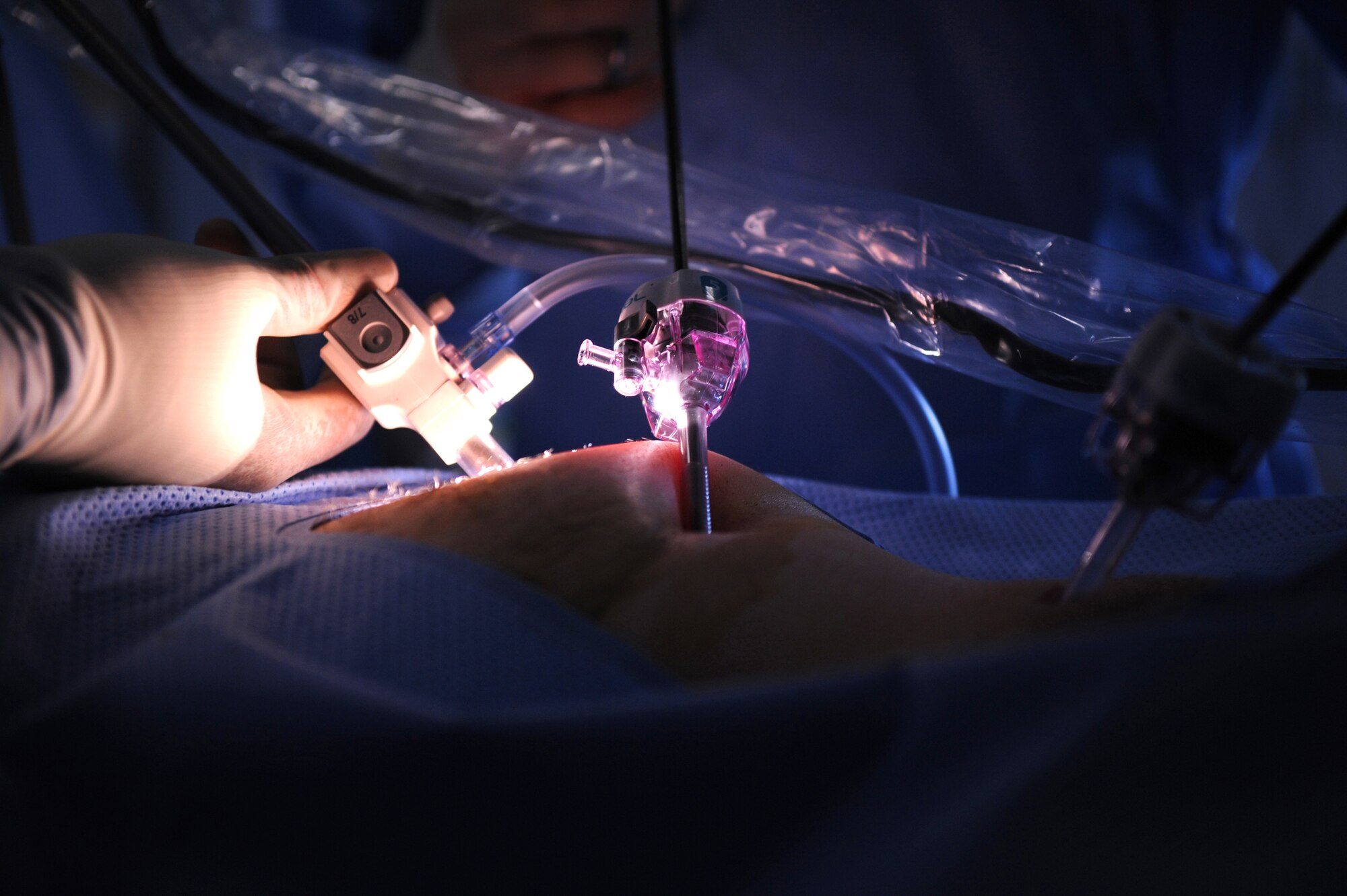 Staff Sgt. Troy Leach, 379th Expeditionary Medical Group surgical clinic and respiratory therapist, uses a laparoscopic fiber optic camera to aid Major (Doctor) Brian Holt, 379th Expeditionary Medical Group general surgeon, in an operation for an inguinal hernia, June 5, 2009, at an undisclosed location in Southwest Asia.  This specific surgery allows the patient to return to duty quicker and with less pain.  The surgeries performed here range from elective to acute emergencies.  The surgical team provides treatment for patients coming in from all over the U.S. Central Command's Area of Responsibility.  Sergeant Leach hails from Nashville Tenn. and is deployed from Keesler Air Force Base, Miss.  Major Holt hails from St. Peters, Mo. and is deployed from Misawa Air Base, Japan.  Both are deployed in support of Operations Iraqi and Enduring Freedom and Combined Joint Task Force - Horn of Africa.  (U.S. Air Force photo/Senior Airman Andrew Satran/released)