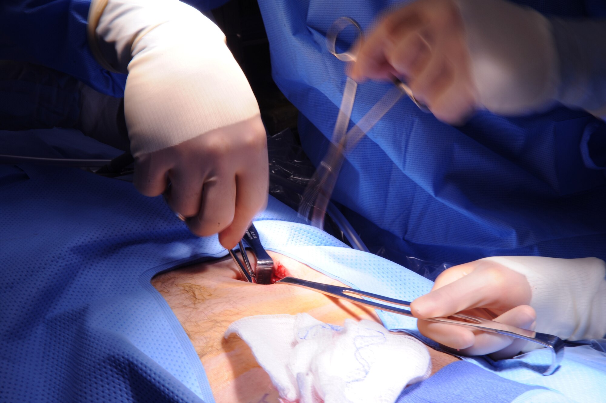Major (Doctor) Brian Holt, 379th Expeditionary Medical Group General Surgeon, opens the anterior abdominal wall fascia to open ports to aid in an operation for an inguinal hernia, June 5, 2009, at an undisclosed location in Southwest Asia.  This specific surgery allows the patient to return to duty quicker and with less pain.  The surgeries performed here range from elective to acute emergencies.  The surgical team provides treatment for patients coming in from all over the U.S. Central Command's Area of Responsibility.  Major Holt hails from St. Peters, Mo. and is deployed from Misawa Air Base, Japan in support of Operations Iraqi and Enduring Freedom and Combined Joint Task Force - Horn of Africa.  (U.S. Air Force photo/Senior Airman Andrew Satran/released)