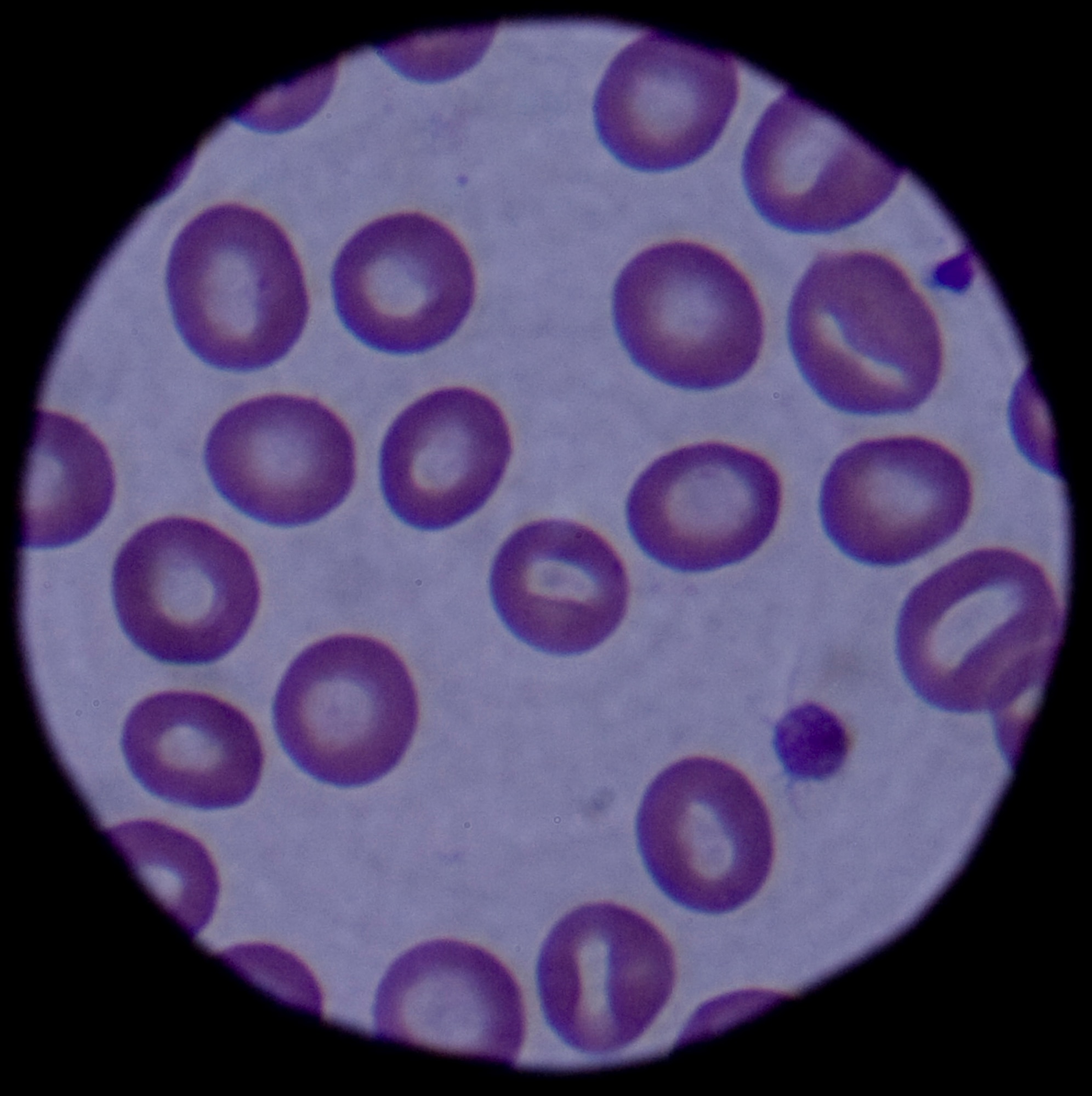 Red and white blood cells are shown through the microscope March 4, 2009, Eielson Air Force Base, Alaska. The cells are magnified by 100x making it easier for the lab technician to count the white blood cells for signs of infection. (U.S. Air Force photo/Airman 1st Class Laura Max)