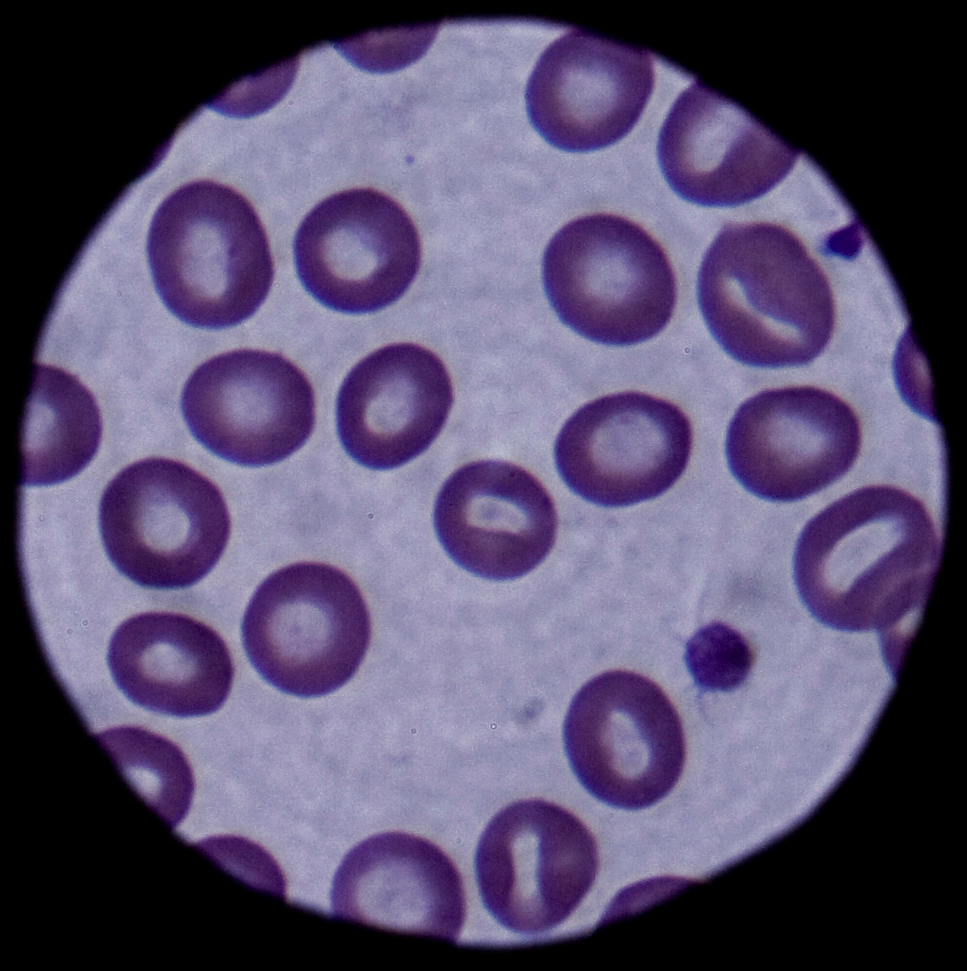 Red and white blood cells are shown through a microscope March 4 at the 354th Medical Group laboratory at Eielson Air Force Base, Alaska. The cells are magnified 100 times, making it easier for a lab technician to count the white blood cells for signs of infection. (U.S. Air Force photo/Airman 1st Class Laura Max) 
