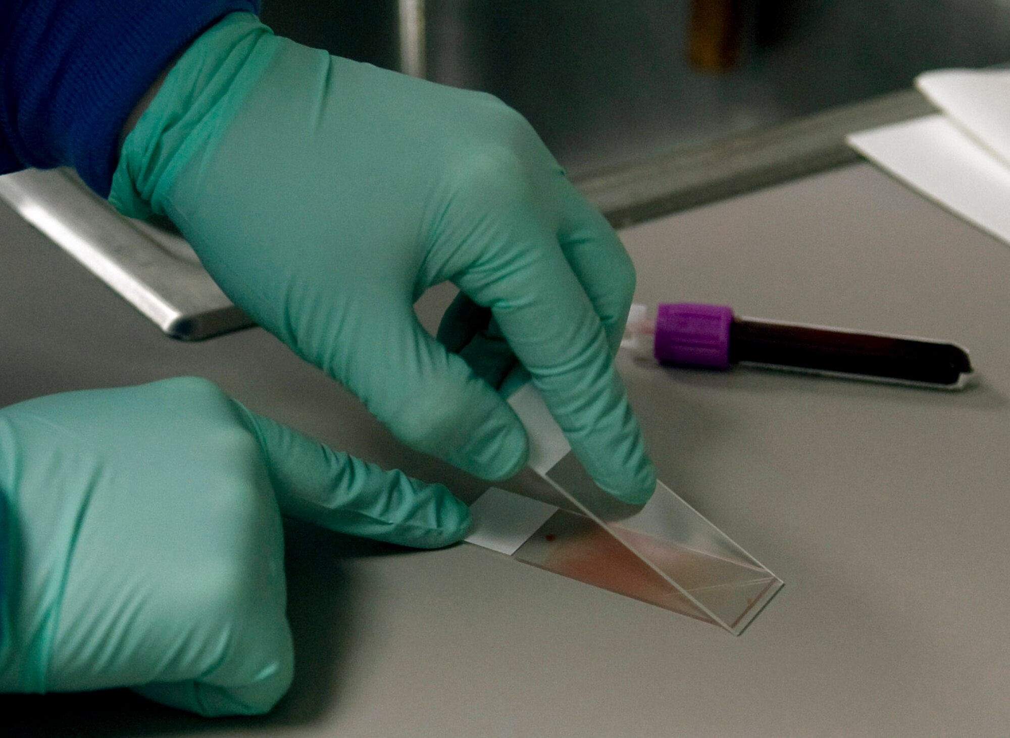 Staff Sgt. Toni Thompson prepares a speciman slide March 4 at Eielson Air Force Base, Alaska. Specimens are made into peripheral smears for examination under a microscope for different diseases. Sergeant Thompson is a 354th Medical Group clinical lab technician. (U.S. Air Force photo/Airman 1st Class Laura Max) 
