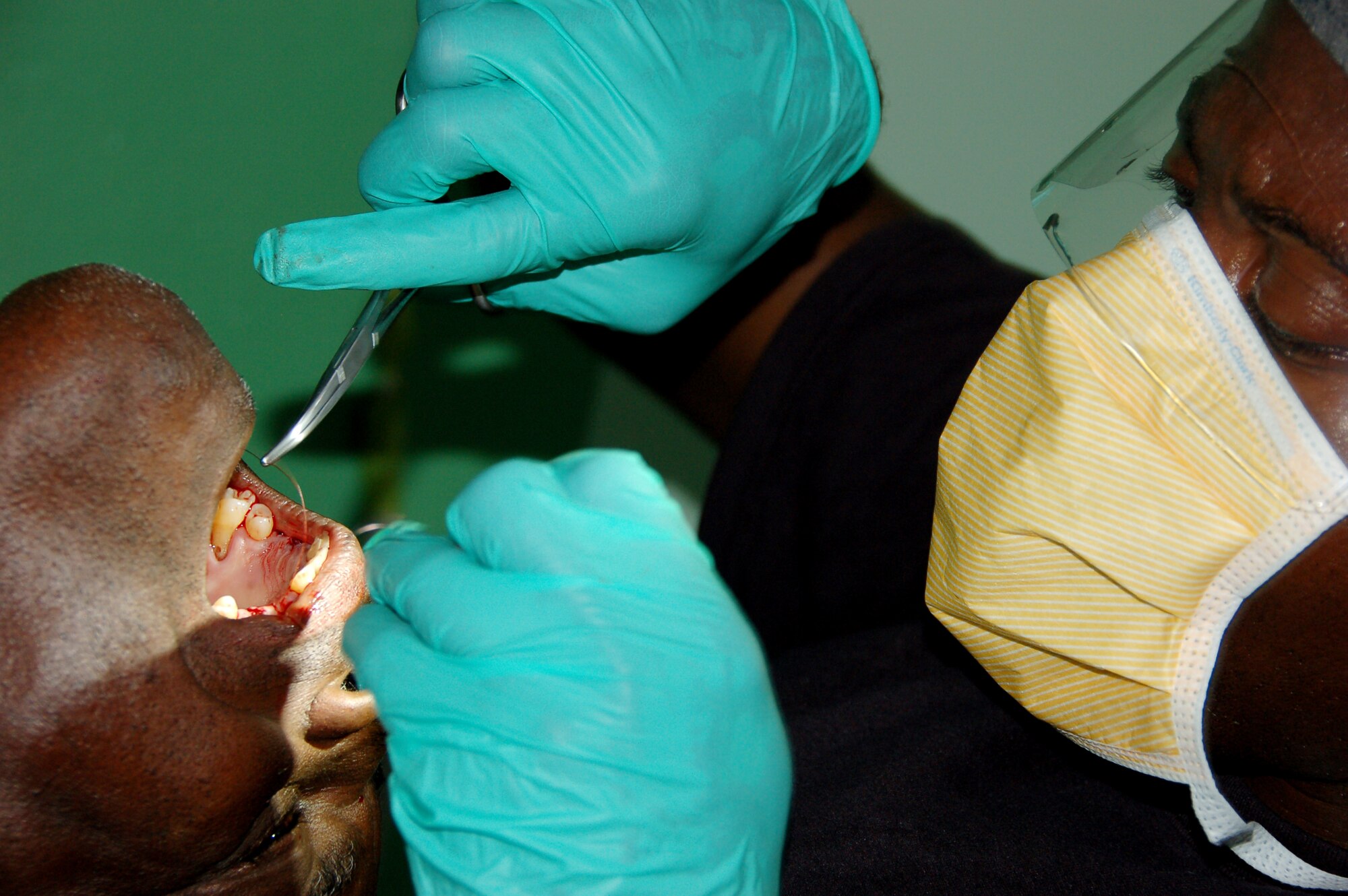 Capt. Keiron T. Kennedy, a Flight Surgeon from the 42nd Medical Group at Maxwell Air Force Base, Ala., sutures the gums of a patient who had six rotten tooth-stubs removed at a primary school turned temporary clinic in Hostos, Dom. Rep., April 22, during the largest Maxwell Air Force Base-planned U.S. Air Force Medical Readiness Training Exercise (MEDRETE) to date. A group of 45 medics, translators, security and support personnel derived from the U.S. Air Force, Army and Marines provided dental, dermatologic, general medicine, optometric, pediatric, pharmacy and public health services. The medics treated 2,800 patients during the first three days of the U.S. SOUTHCOM sponsored Beyond the Horizon 2009 – Caribbean. A MEDRETE is a U. S. Southern command-sponsored exercise designed to provide humanitarian assistance and free medical care to the people of the host nation, while providing an unparalleled training opportunity for U.S. and host nation forces. SOUTHCOM sponsors approximately 70 MEDRETEs per year. (U.S. Air Force Photo by Capt. Ben Sakrisson)