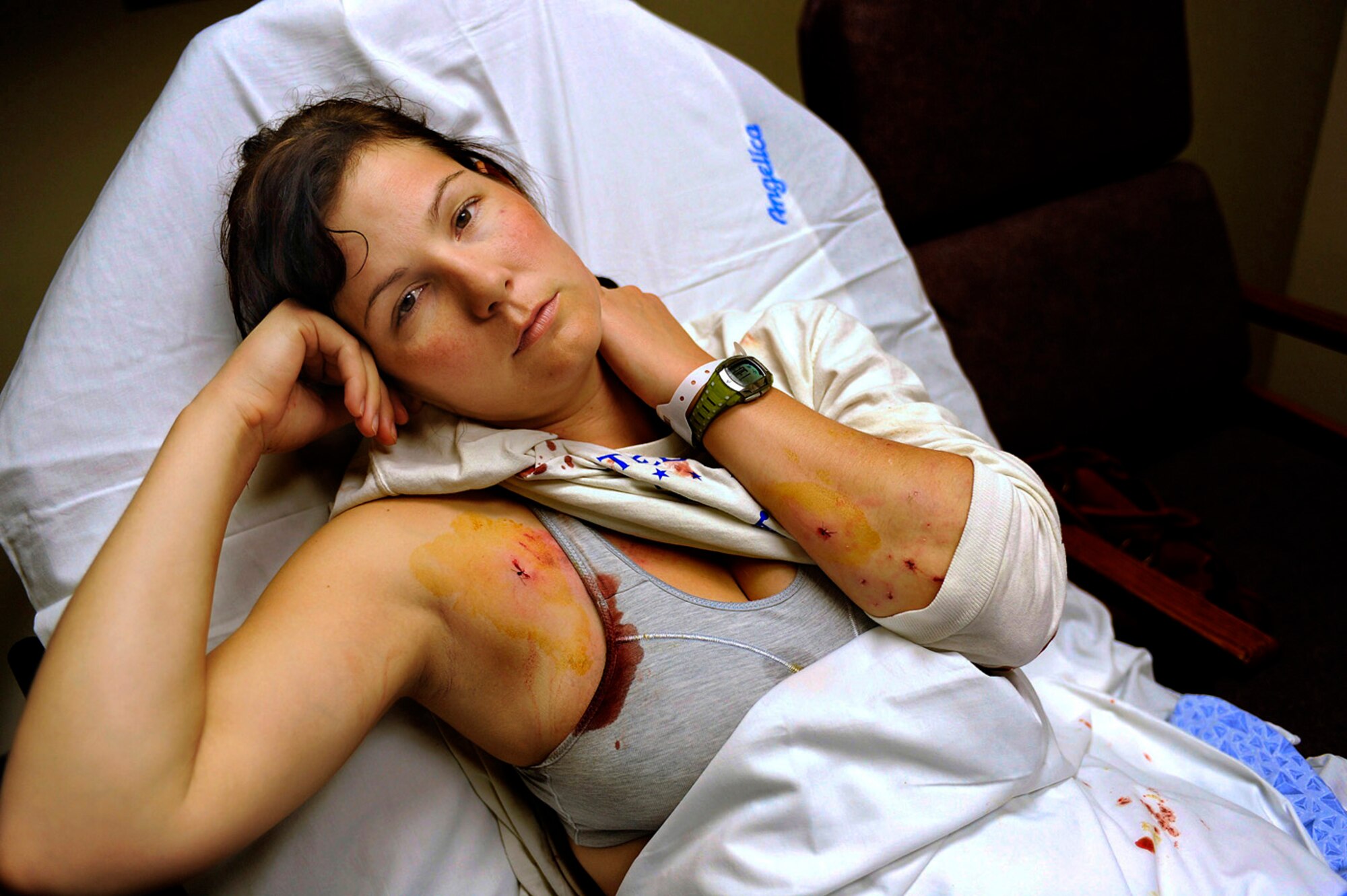 Stacy Pearsall recovers from a dog attack in Trident Regional Medical Center, S.C., Dec. 18. A chow-husky mix, which was not on a leash, mauled her while she was out on an early morning jog. (photo by Master Sgt. Andy Dunaway)