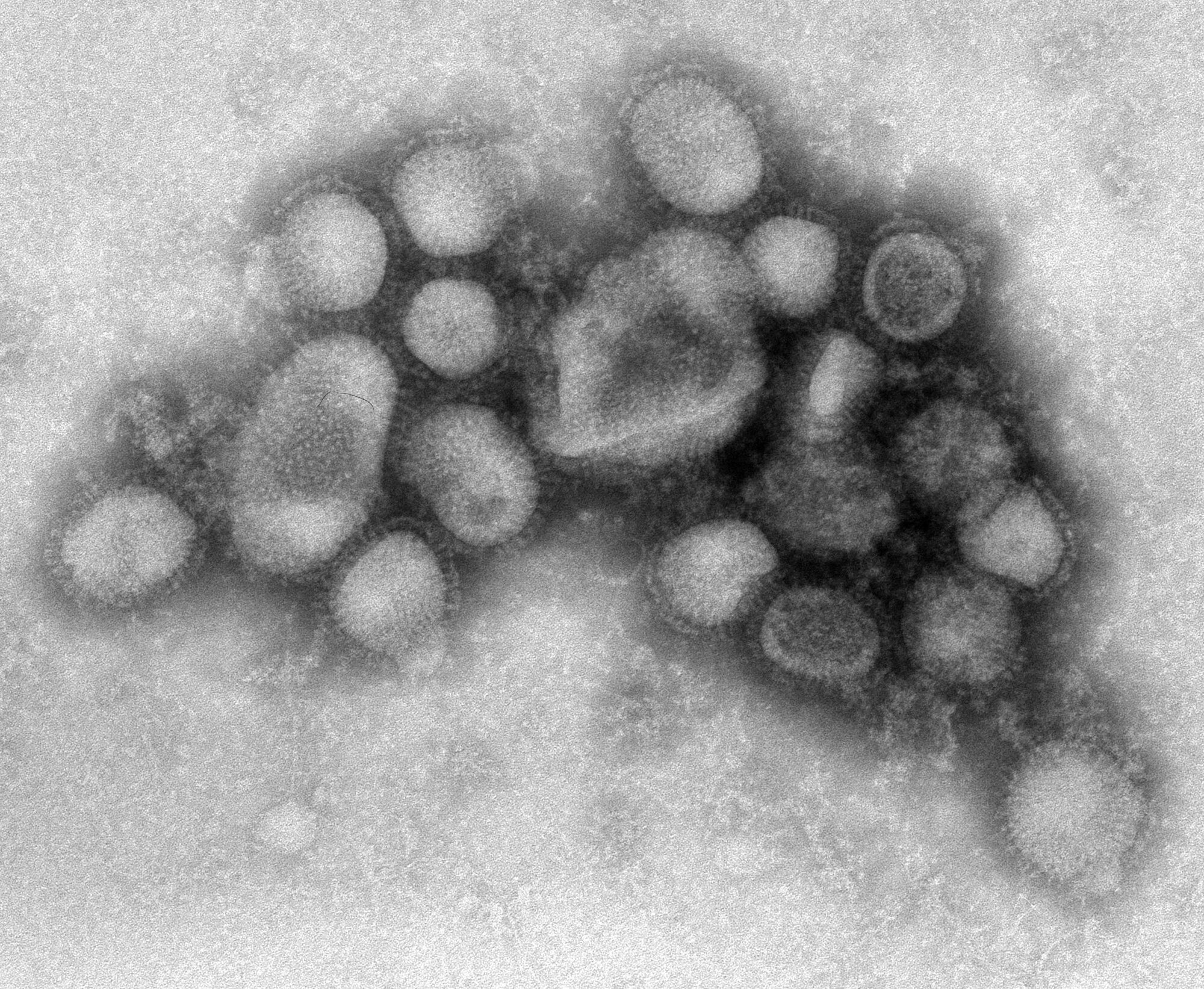 The H1N1 flu strand as seen under a microscope.  SOURCE: www.CDC.gov