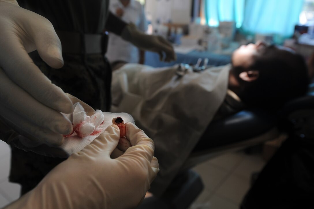 Medical personnel with the 11th Marine Expeditionary Unit dispose of a decayed tooth after extracting it from a patient at a local clinic here Oct. 16. Marines and sailors with the unit are in Timor Leste providing health services as part of an exercise with the Timor Leste military focusing on medical, dental and engineering projects and military interaction.