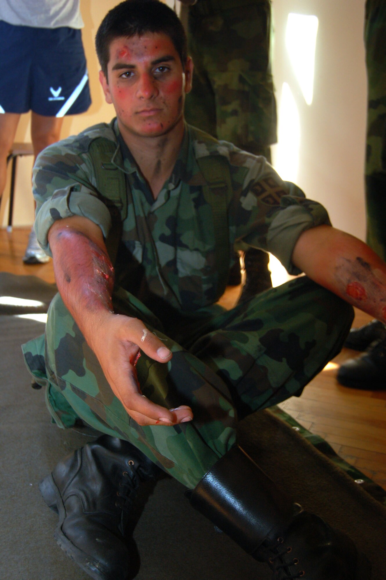 NIS, Serbia – Stefan Krstic, Serbian Armed Forces soldier, shows the mock burns on his arms Sept. 4 during a military medical training exercise in Central and Eastern Europe, or MEDCEUR 2009, trauma nursing course. Moulage was applied to the soldier’s arms to simulate burns to create a more real situation for class participants to treat. (U.S. Air Force photo/Senior Airman Kali L. Gradishar)