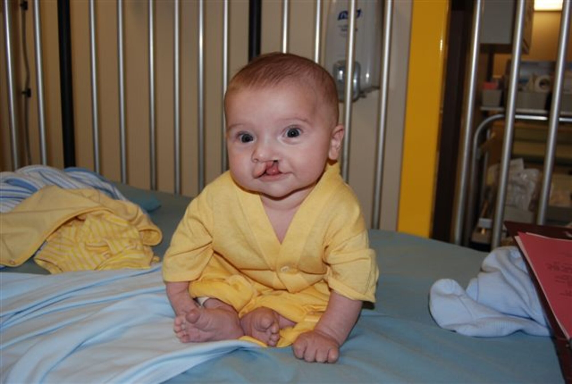 Jimmy Baker, son of Senior Airman Josh Baker and his wife, Joleen, shown here in 2008 prior to surgery to repair his cleft palate and lip. The Air Force Aid Society provided a $3,500 medical grant so that the Baker family could be together in Hawaii for Jimmy's surgery. (Courtesy photo)