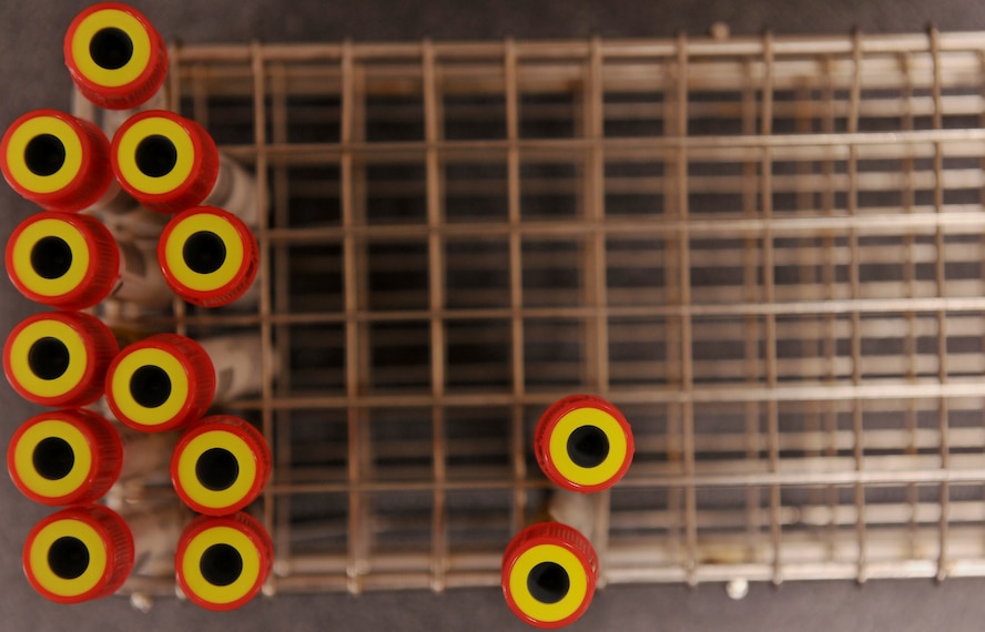 MOODY AIR FORCE BASE, Ga. -- Vials of blood sit in a rack waiting to be tested here Aug. 1. Technicians at the 23rd Medical Group clinical laboratory went through a two-day inspection conducted by the College of American Pathologists and scored the highest possible rating of "outstanding.” (U.S. Air Force photo/Airman Class Joshua Green)