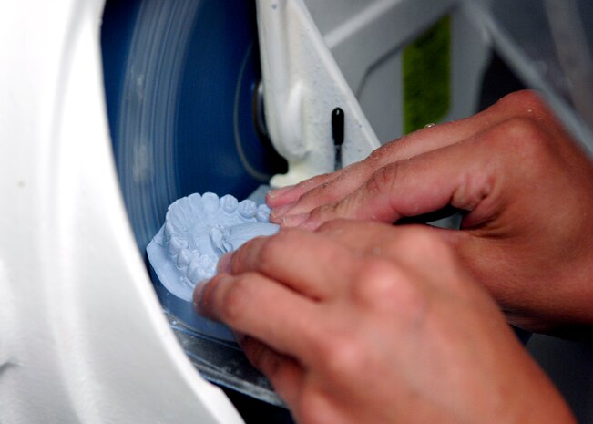 Kathy Dietrich trims off access stone and fine tunes a patient's lower jaw cast at the Deily Dental Clinic June 8, 2010, on Joint Base Charleston, S.C. Casts of patients' teeth can assist in replicating an artificial jaw of the patient so doctors may study and analyze even when the patient has departed. Casts of teeth also allow the dental clinic to make hard guards, essex retainers, crowns and bridges for patients. Mrs. Dietrich is a dental technician with the 628th Medical Group. (U.S. Air Force photo/Senior Airman Timothy Taylor)