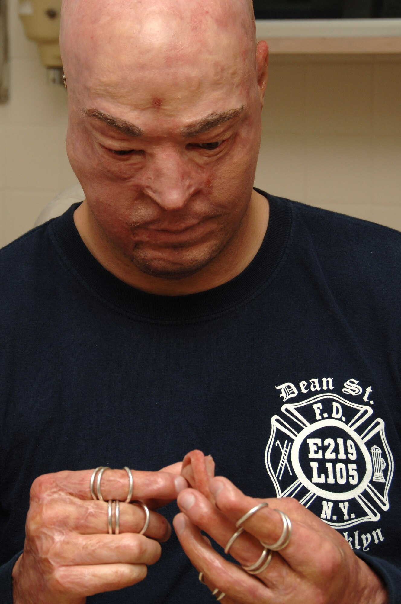 Capt. Ryan Voltin inspects his ear prosthesis prior to placement at MacKown Dental Clinic, Lackland Air Force Base, Texas, May 7.  The Marine pilot was wounded in a training accident in May 2007 that left him with severe burns and loss of most of his ears and his left leg. (U.S. Air Force photo by Senior Airman Nicole Mickle)
