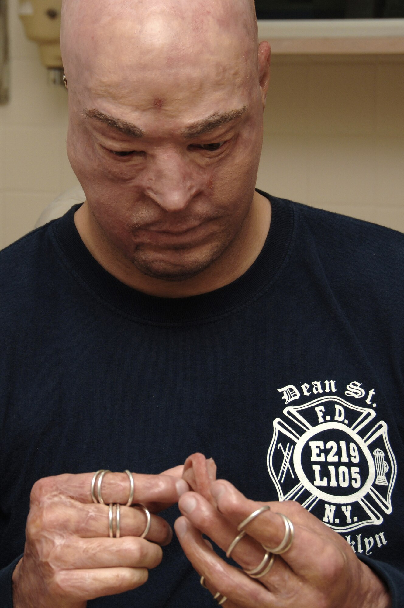 Marine Capt. Ryan Voltin inspects his ear prosthesis prior to placement May 7, 2010, at the MacKown Dental Clinic at Lackland Air Force Base, Texas. Captain Voltin was wounded in a training accident in May 2007 that left him with severe burns and loss of most of his ears and his left leg. (U.S. Air Force photo/Senior Airman Nicole Mickle)
