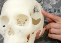 A model of Tech. Sgt. Carmen Colon-Alemany's skull shows where doctors removed a tumor and later a tumor re-growth during two surgeries in 2004 and 2009. The dent in the model shows where her skull didn't fuse properly -- a problem her second surgery fixed. (U.S. Air Force photo/Staff Sgt. Carolyn Viss)