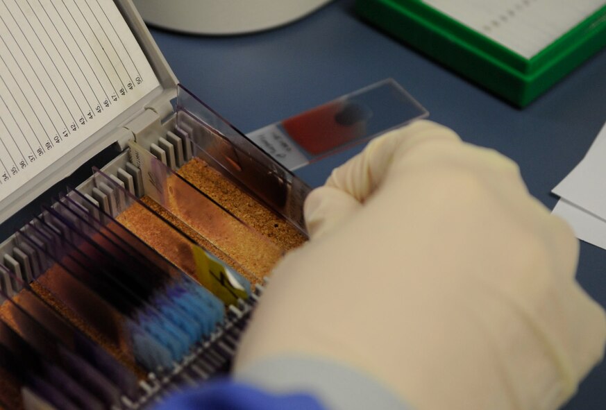 Senior Airman Marthinus Taljaard, 2nd Medical Group clinical laboratory technician, reads a patient's blood sample slide at the 2 MDG lab at Barksdale Air Force Base, La., Dec. 15. The slides are used to help diagnose infection. The 2 MDG laboratory was recently named the Air Force Global Strike Command laboratory team of the year. (U.S. Air Force photo/Staff Sgt. Terri Barriere)