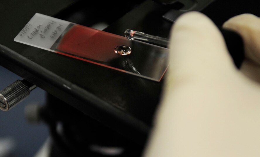 Senior Airman Marthinus Taljaard, 2nd Medical Group clinical laboratory technician, reads a patient's blood sample slide at the 2 MDG lab at Barksdale Air Force Base, La., Dec. 15. The slides are used to help diagnose infection. The 2 MDG laboratory was recently named the Air Force Global Strike Command laboratory team of the year. (U.S. Air Force photo/Staff Sgt. Terri Barriere)