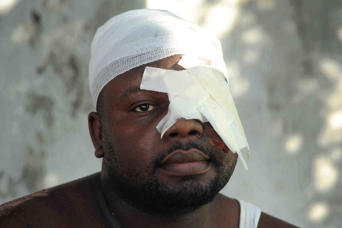 A bandaged Haitian man sits after being treated for a facial burn, Jan. 20, 2010, at University Hospital in Port-Au-Prince, Haiti.