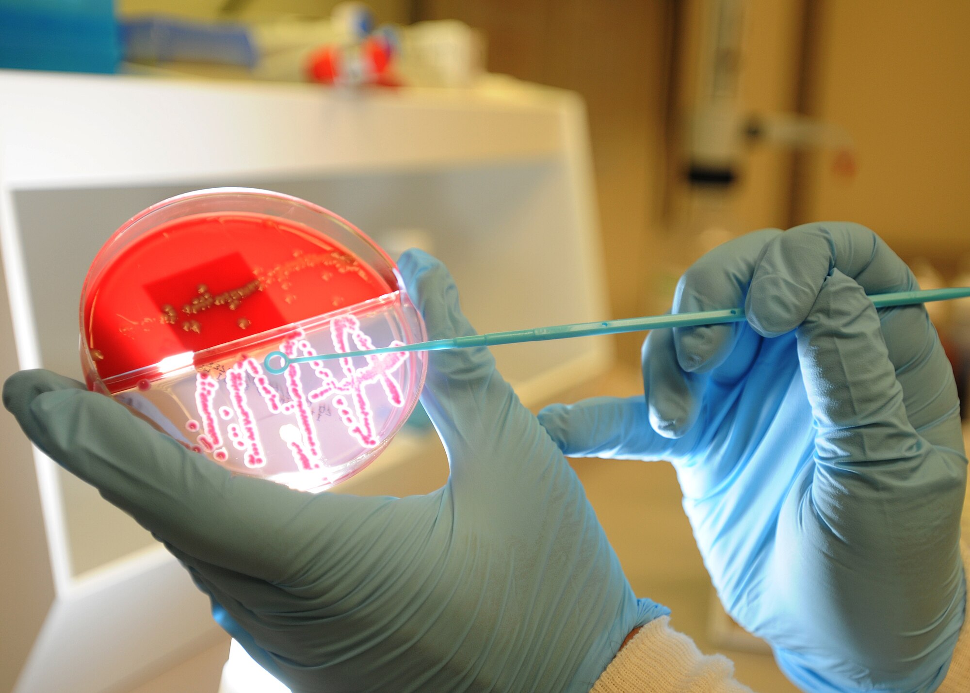 Airman 1st Class Jeremy Jackson, 31st Medical Support Squadron laboratory technician, examines a culture plate July 20 at the medical laboratory.  These plates are used to identify microorganisms in urine and fecal matter.  (U.S. Air Force photo/Senior Airman Tabitha M. Lee)