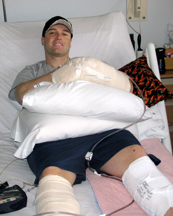 Staff Sgt. Jason Butterfield, an intelligence analyst with the 151st Operations Group Intelligence, in recovery February 2009 at Brooke Army Medical Center in San Antonio, Texas. Sergeant Butterfield suffered a left wrist and hand injury when riding in the turret of a Mine Resistant Ambush Protected (MRAP) vehicle, which rolled near Helmand province, Afghanistan Feb. 10, 2009. 	
