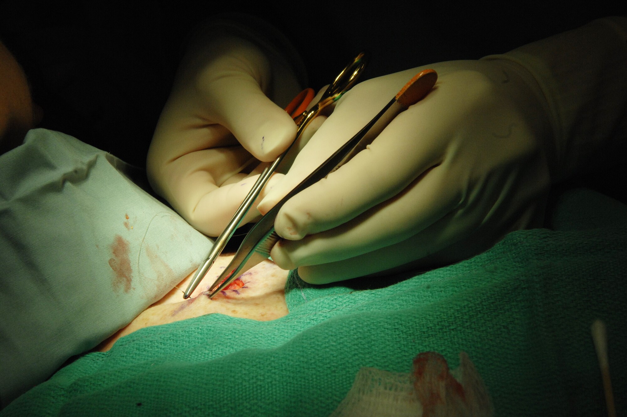 ELMENDORF AIR FORCE BASE, Alaska -- Major Joy Wu, 3rd Wing Medical Group, dermatology chief stitches a patient after surgery to remove a section of skin with basal cell skin cancer. (Air Force photo by Airman 1st Class Jack Sanders)