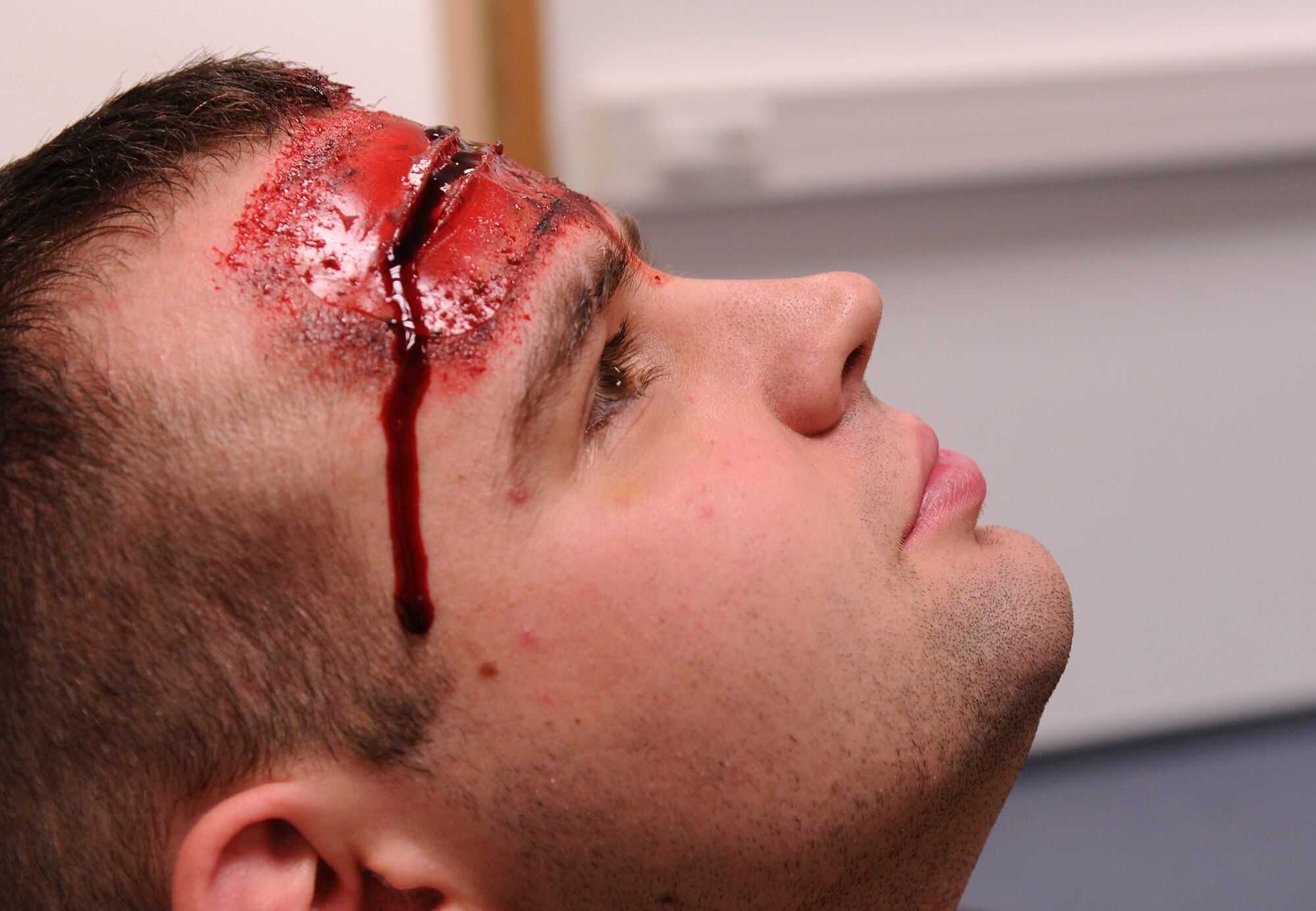 SPANGDAHLEM AIR BASE, Germany – Airman 1st Class Steven Ferguson, 52nd Force Support Squadron, waits for the final touches to be applied to his mock wounds during Operation Saber Crown 10-04 here March 1. Moulage, the art of applying mock injuries for training, is used to help assess self-aid and buddy care knowledge for Airmen during exercises. (U.S. Air Force photo/Senior Airman Nathanael Callon)