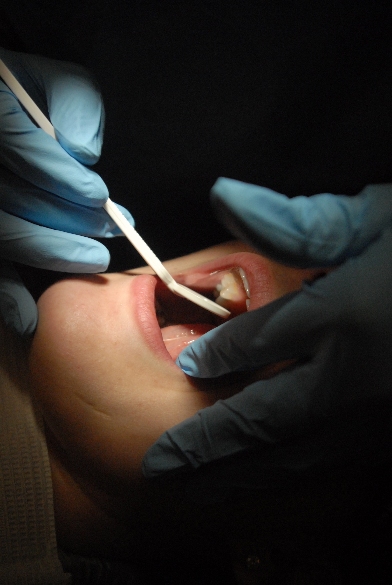 A dental assistant uses a hand mirror during a dental procedure.  Since many teeth are difficult to observe directly, the dental team uses indirect visualization. The
mirror becomes the main source of visualization. (U.S. Air Force photo/Airman 1st Class Anne Gathua)
