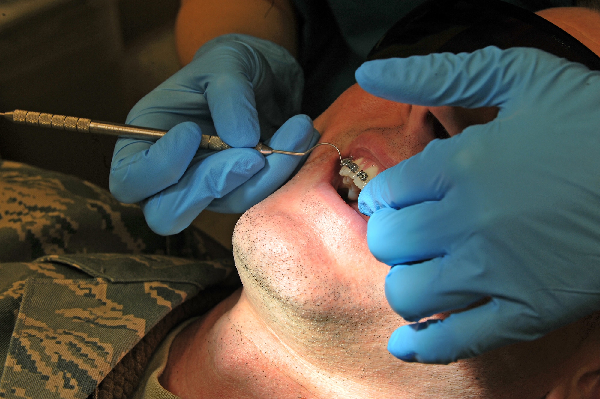 OFFUTT AIR FORCE BASE, Neb. - A spotlight aides Staff Sgt. Jessica Chang, with the 55th Dental Squadron in the Ehrling Bergquist Clinic, as she checks the braces of Master Sgt. Justin King, first sergeant with the 55th Wing Staff, March 11. The 55th DS's orthodontics section provides support to an average of 150-200 patients each month for dental services and treatment.   

U.S. Air Force photo by Charles Haymond