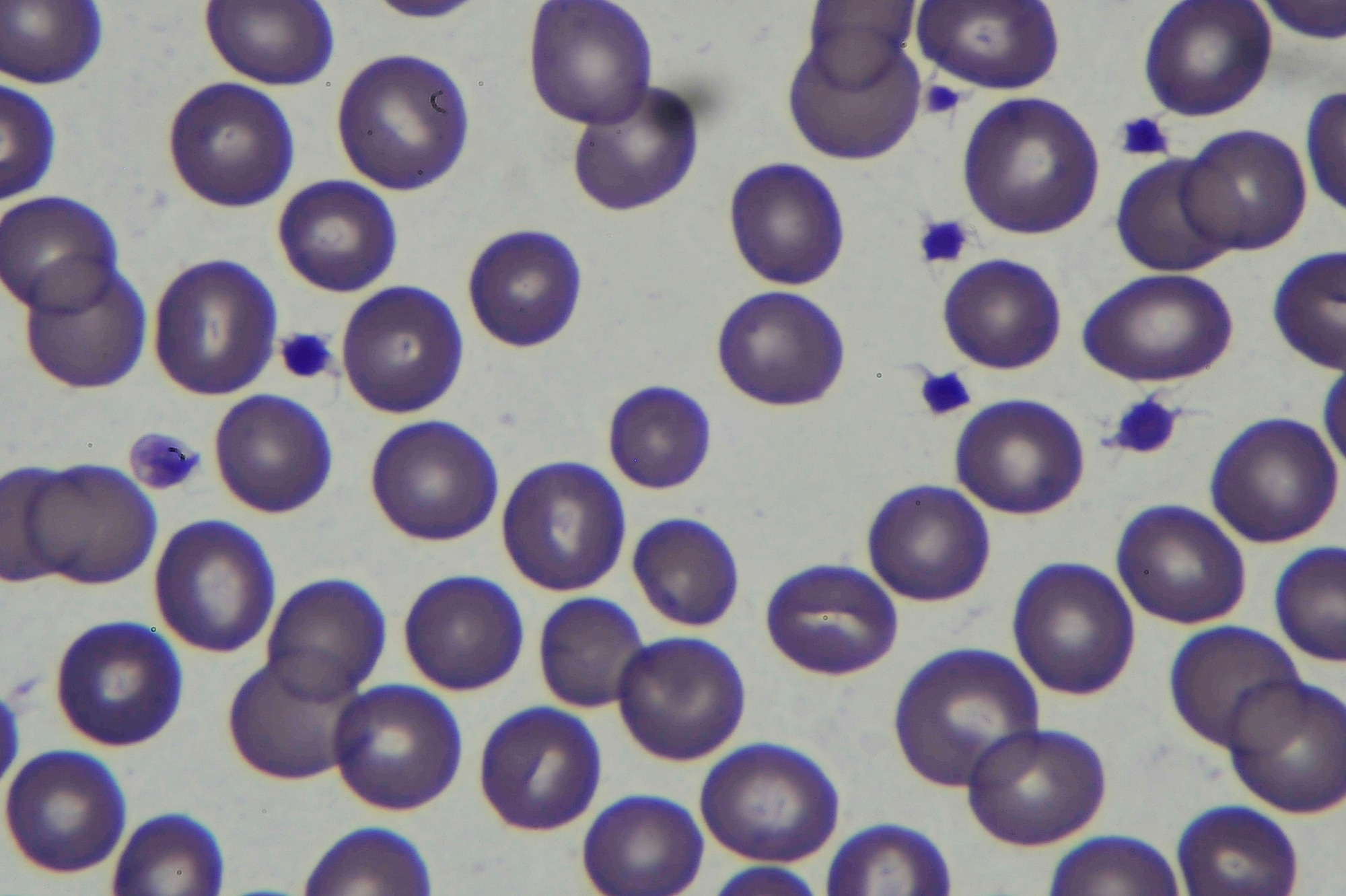 Using a microscope, lab technicians are able to see white and red blood cells. These cells are essential for the body to properly function. Red blood cells carry oxygen while white blood cells help fight infection. (U.S. Air Force photo/Staff Sgt. Christopher Boitz)