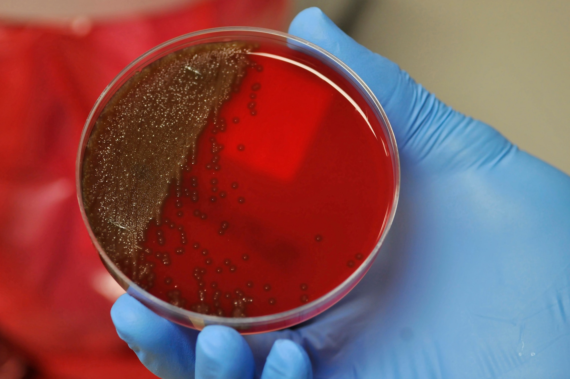Bacteria from a strep throat patient rapidly grows on a Petri dish in the 354th Medical Group laboratory Mar. 11, 2010, Eielson Air Force Base, Alaska. Approximately 75% of Eielson's patient diagnosis comes from lab results. (U.S. Air Force photo/Staff Sgt. Christopher Boitz)