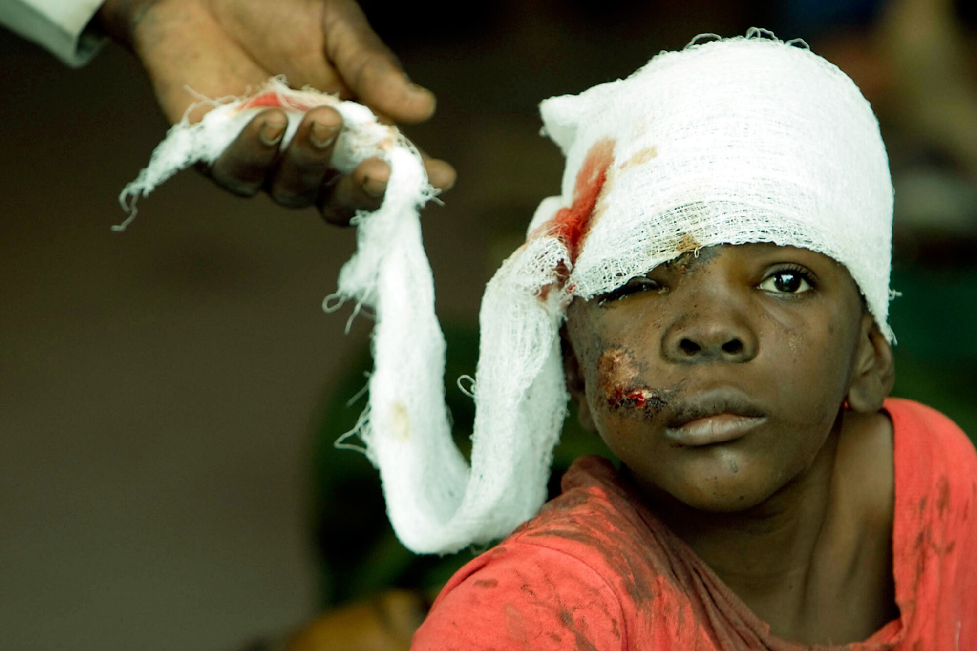 A Haitian boy receives treatment at an ad hoc medical clinic after an earthquake rocked the island nation Jan. 12. (United Nations photo by Logan Abassi)
