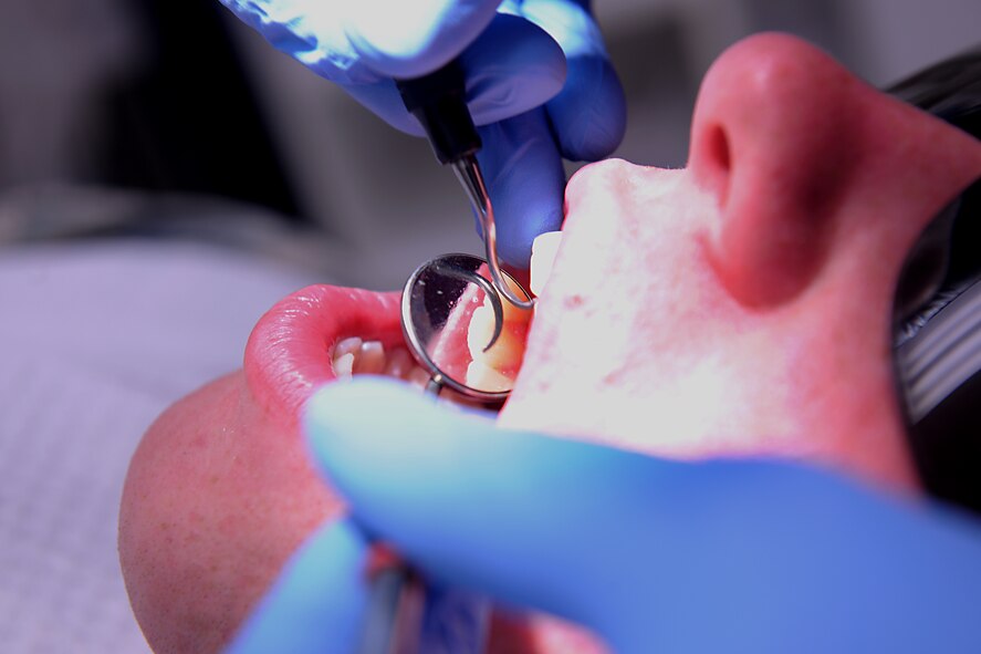 MOODY AIR FORCE BASE, Ga. -- Airman 1st Class Edward Huffman, 822nd Security Forces Squadron member, has his teeth checked with a dental probe, which is used to explore the teeth’s surface and to locate cavities, here May 12. The mirror provides an easier view for the dental technician to get an in-depth look at his patients’ teeth. (U.S. Air Force photo by Airman 1st Class Joshua Green/RELEASED)