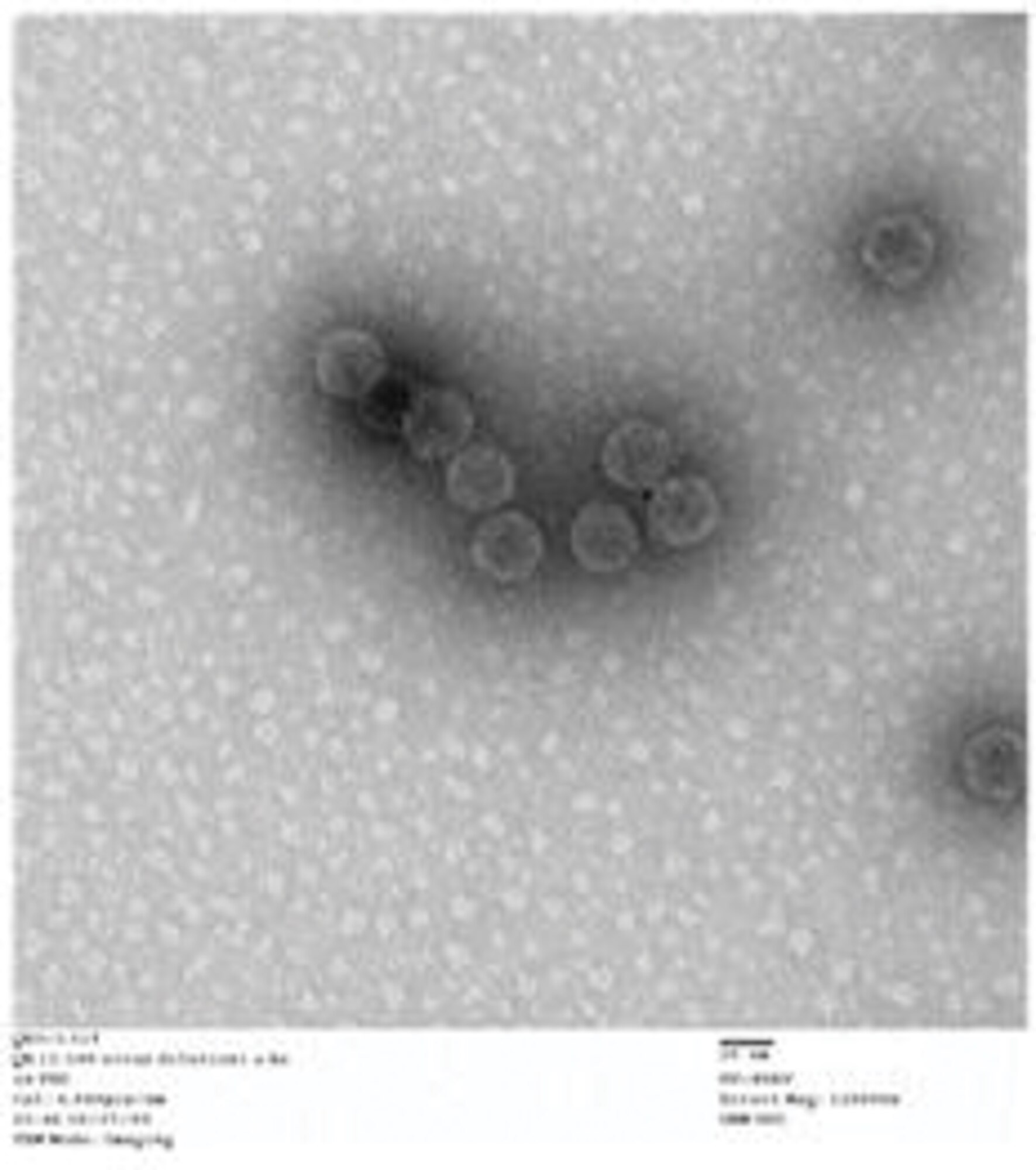 Transmission electron microscope pictures reflect gold nanoparticles attached to viruses. (AFRL image)