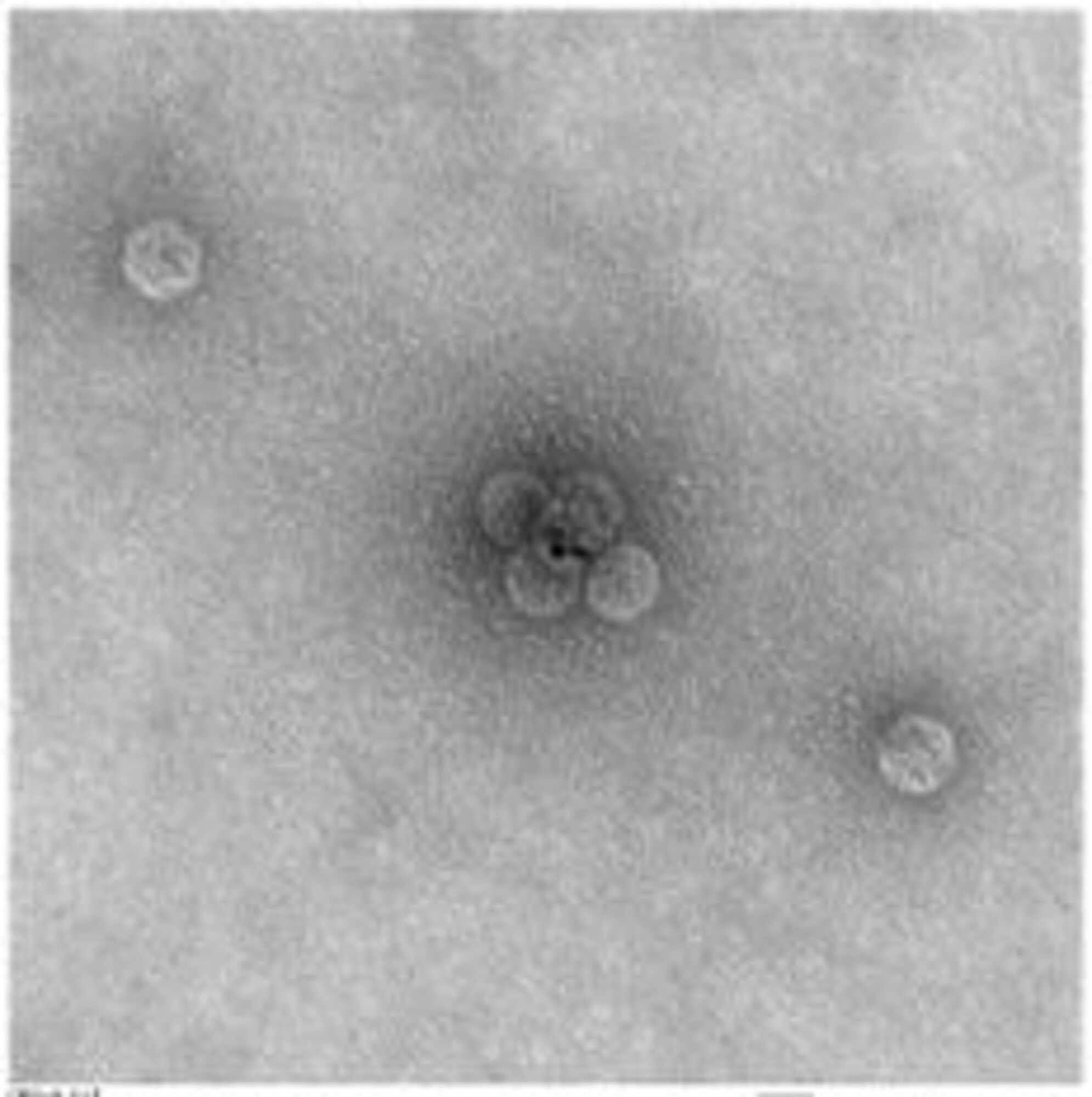 Transmission electron microscope pictures reflect gold nanoparticles attached to viruses. (AFRL image)