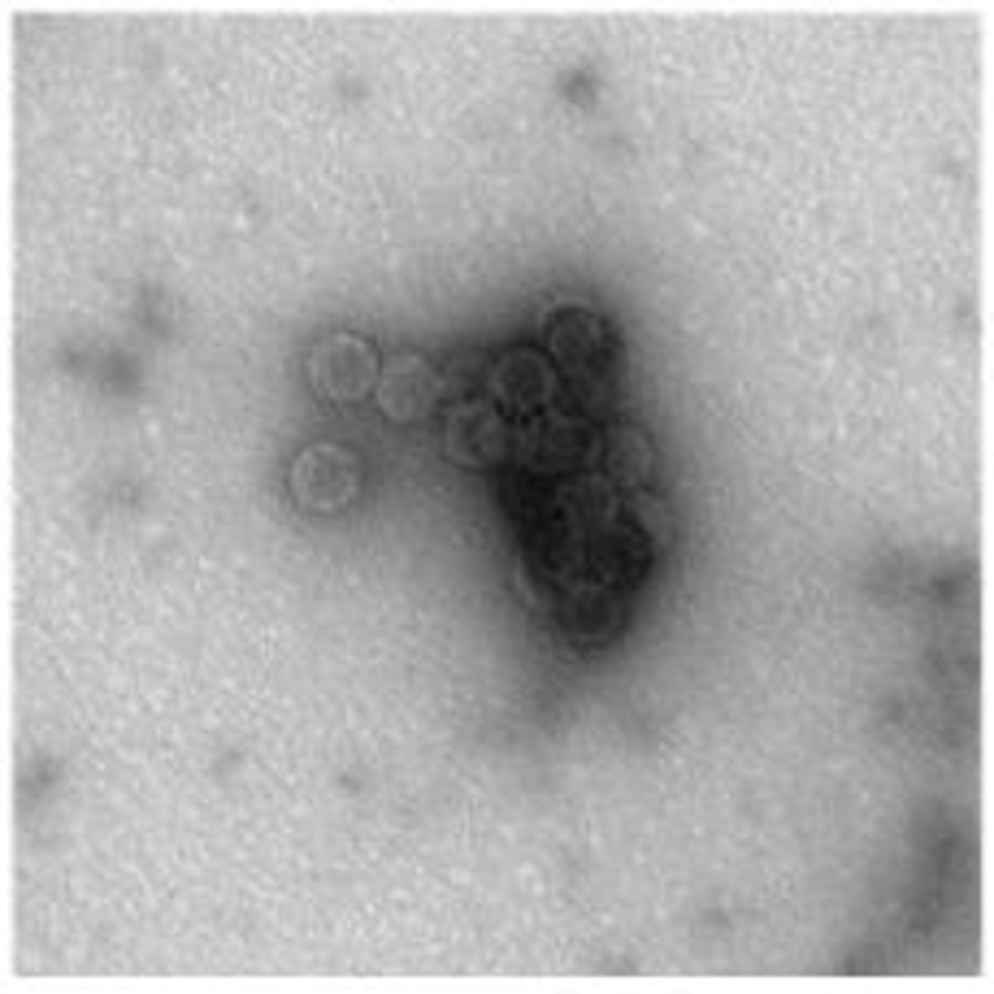 Transmission electron microscope pictures reflect gold nanoparticles attached to viruses. (AFRL image)