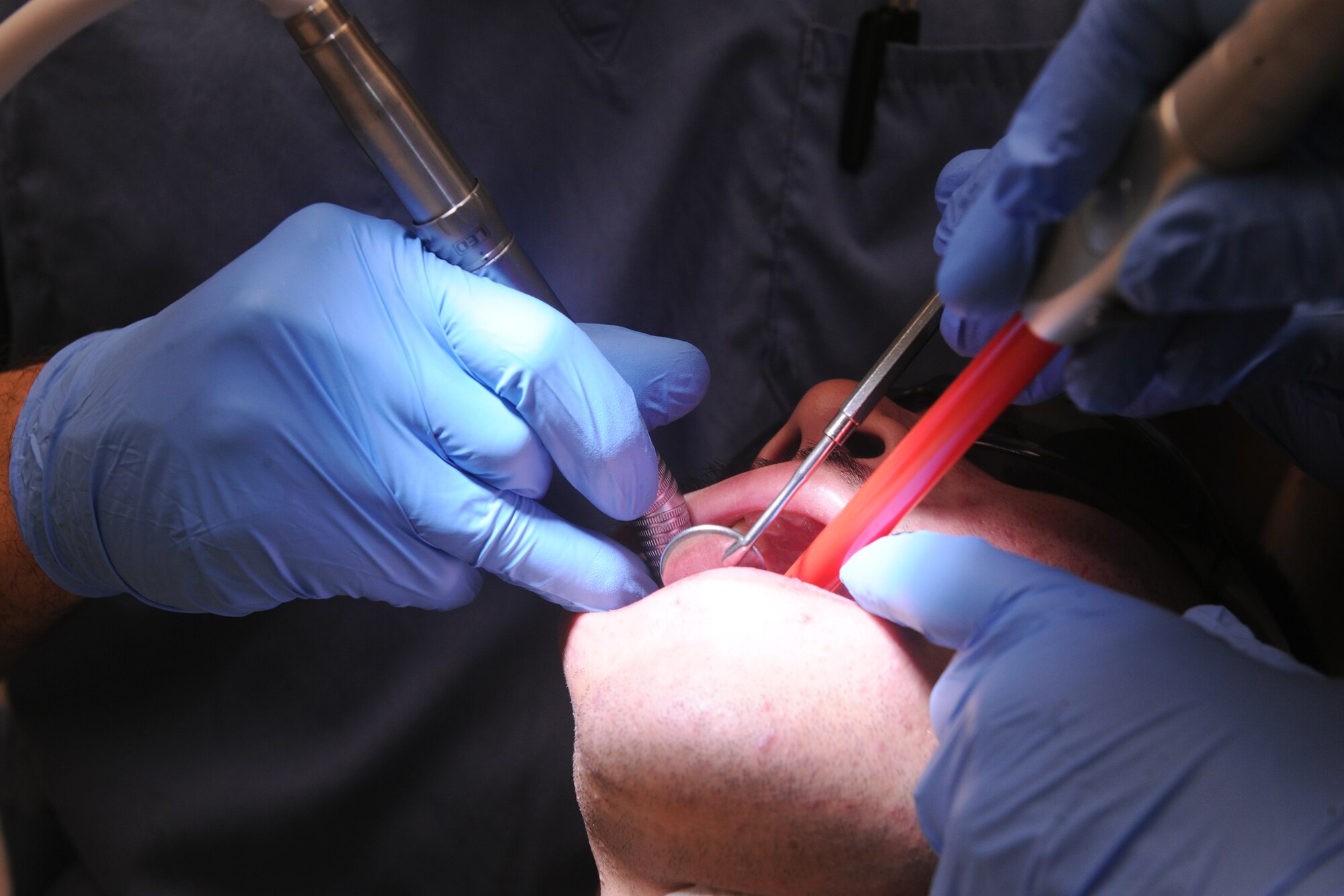 Airman 1st Class Christian Cepeda, 23rd Operation Support Squadron air traffic controller, receives dental care from the 23rd Aerospace Medicine Squadron at Moody Air Force Base, Ga., April 27. Airman Cepeda came to the 23rd Medical Group Dental Clinic for maintenance on a previous root canal. (U.S. Air Force photo/Airman 1st Class Benjamin Wiseman)(RELEASED)
